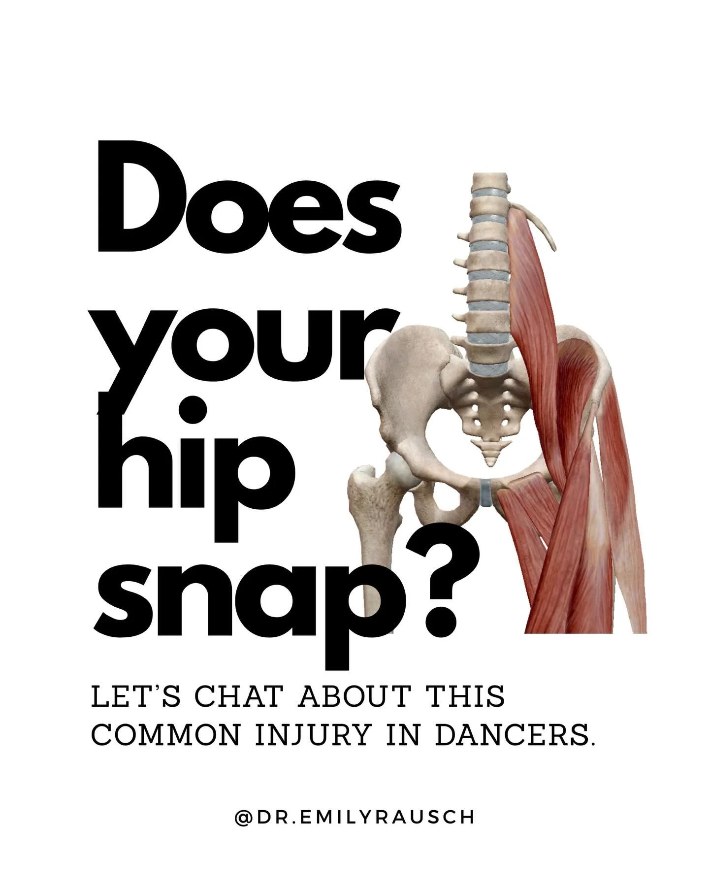 Having a snapping or clunking sensation in your hip with pike or straddle moves? Read this post.

Key takeaways:

➡️ 3 different kinds of snapping hip with different structures being involved.  The structure will dictate what rehab exercises are more