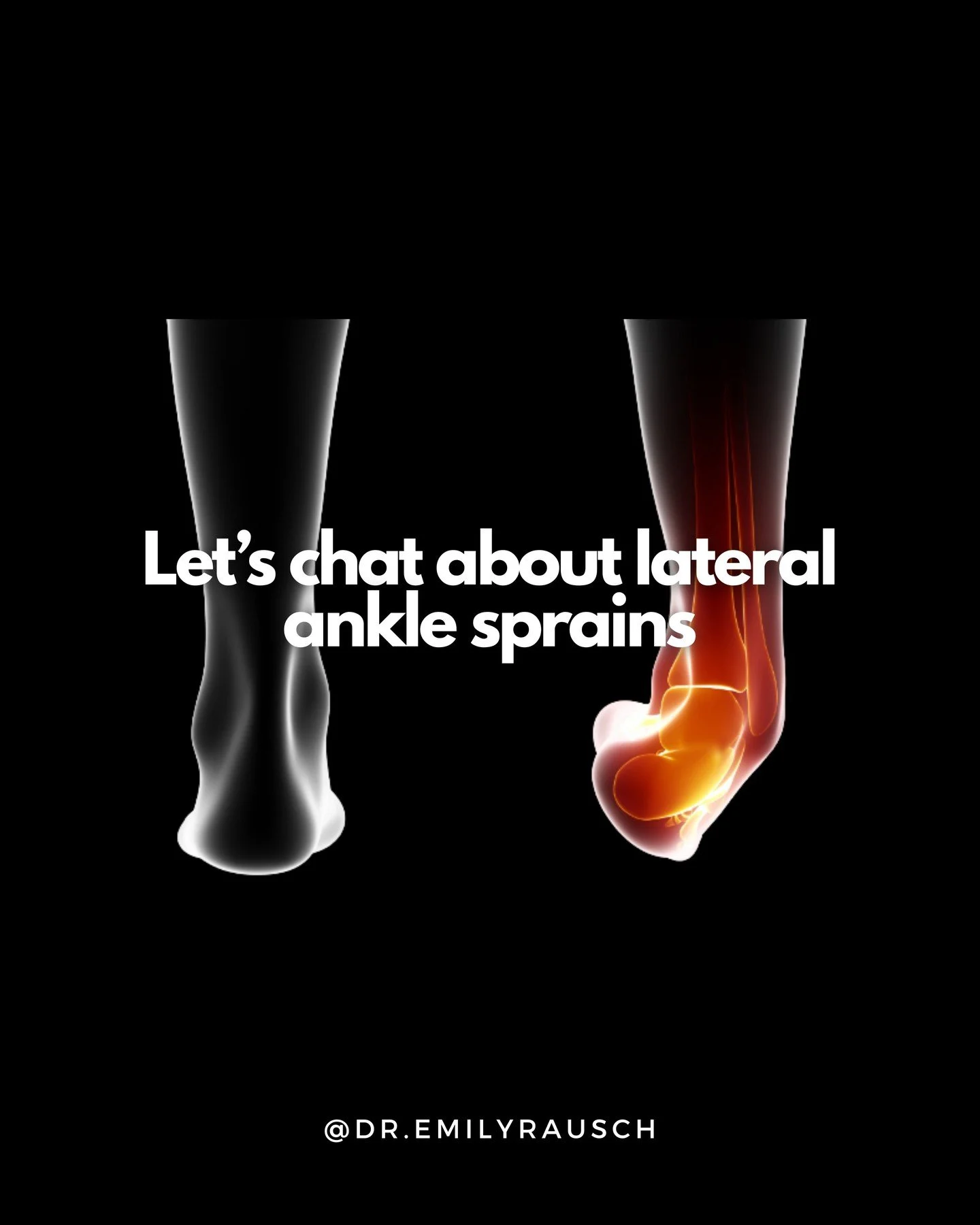 If you're looking for help rehabbing your sprained ankle, I got you. 🖤

Link in bio to schedule an assessment.