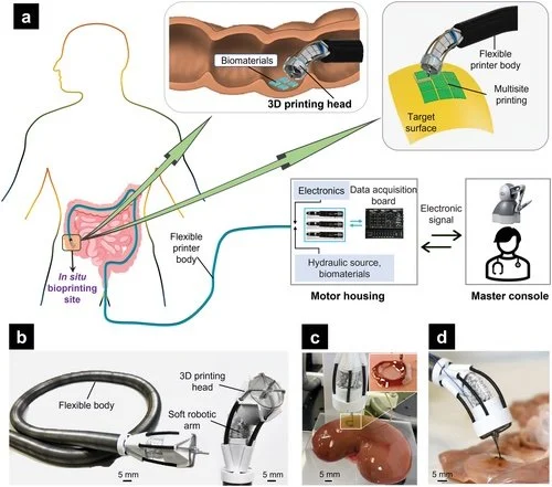 Santé : bientôt des organes soignés à partir d’impression 3D ?