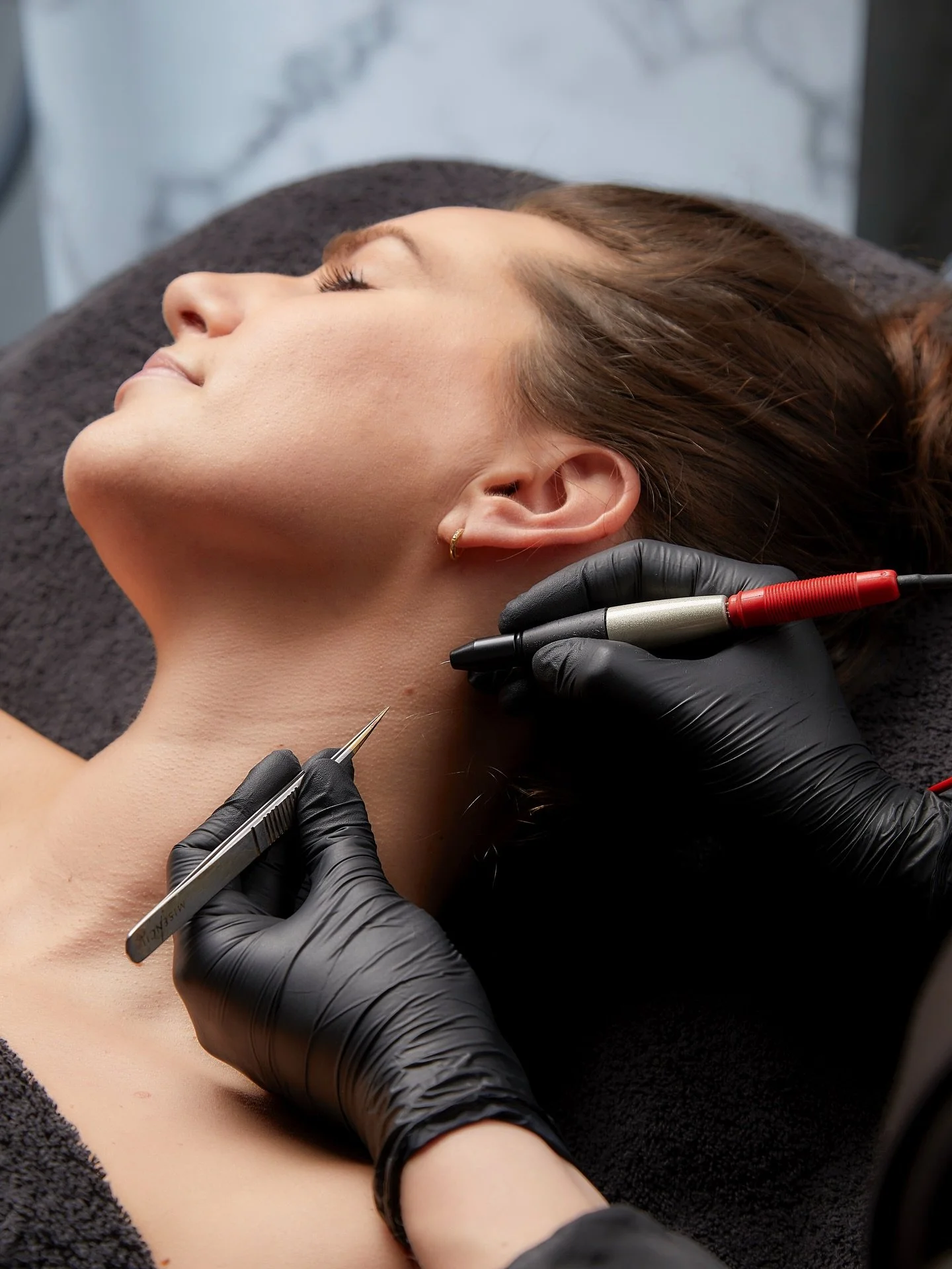 Last van moedervlekken, steelwratjes of verheven ouderdomsvlekken?
Plan een consult voor veilige verwijdering!