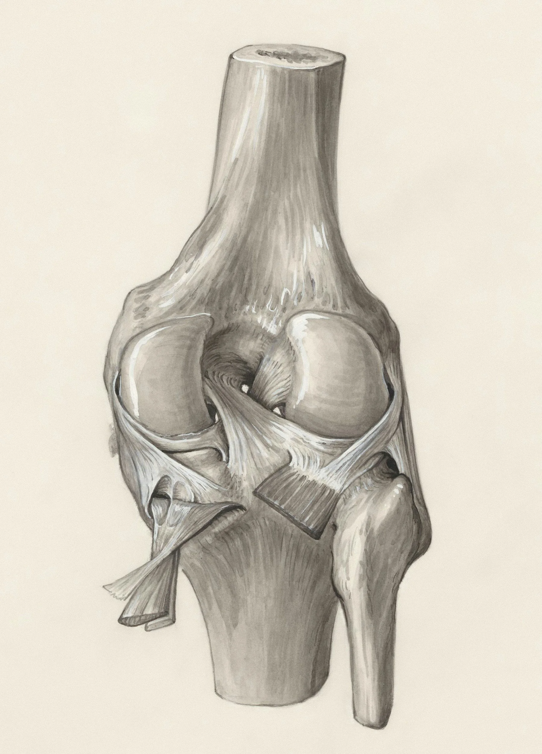 A grayscale drawing of a femur bone with anatomical details, including the pelvic bones attached to the top.