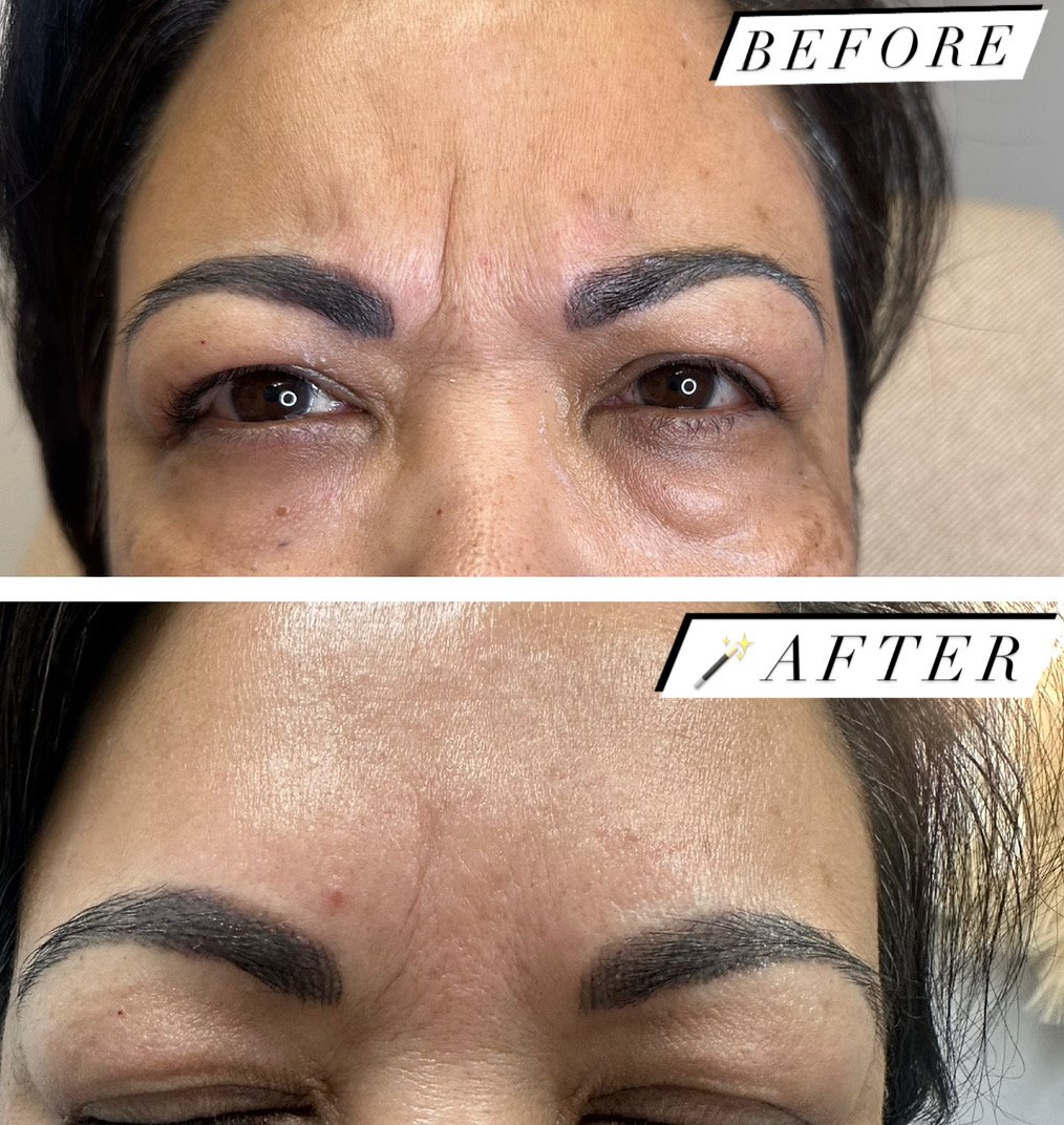 Before and after 3.JPG