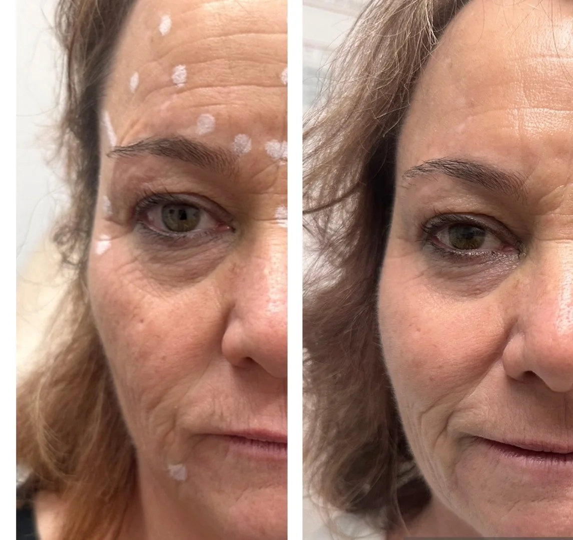 Before and after 1.JPG