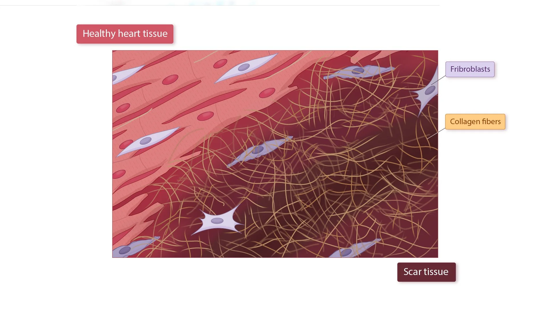 03_04_05_Heart_Cells_Scar_Over-03.jpg