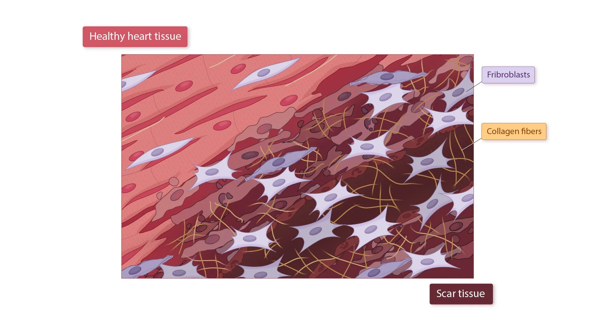 03_04_05_Heart_Cells_Scar_Over-02.jpg