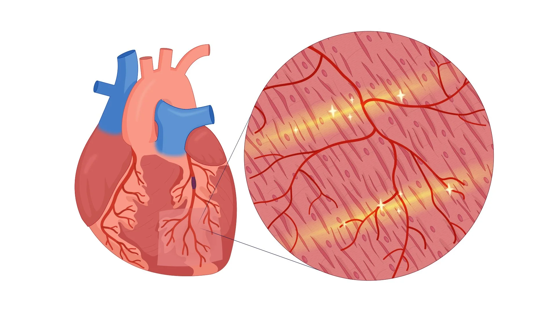 24_Heatlhy_Heart.jpg