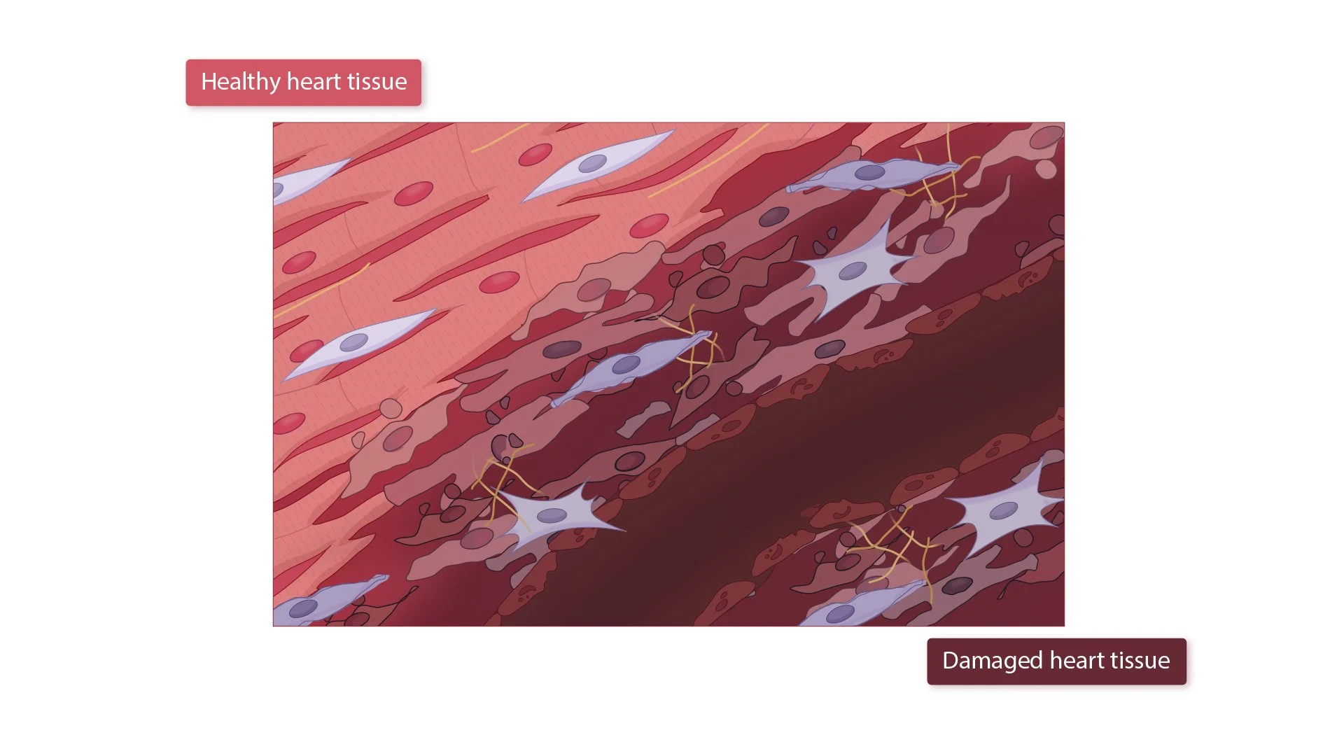 03_04_05_Heart_Cells_Scar_Over-01.jpg