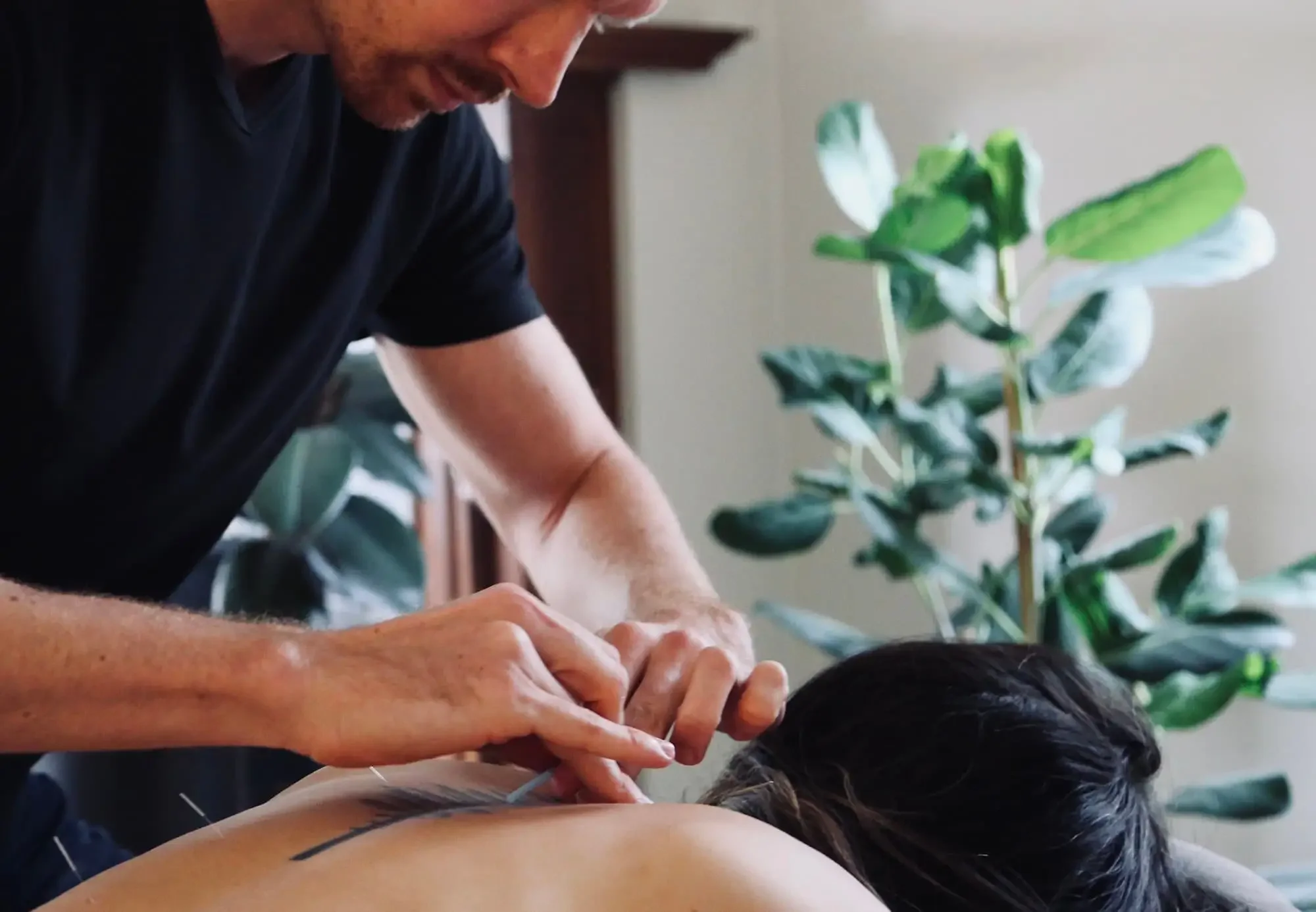 A person giving an acupuncture treatment to a woman lying face down, with a green houseplant and a wooden piece of furniture in the background.