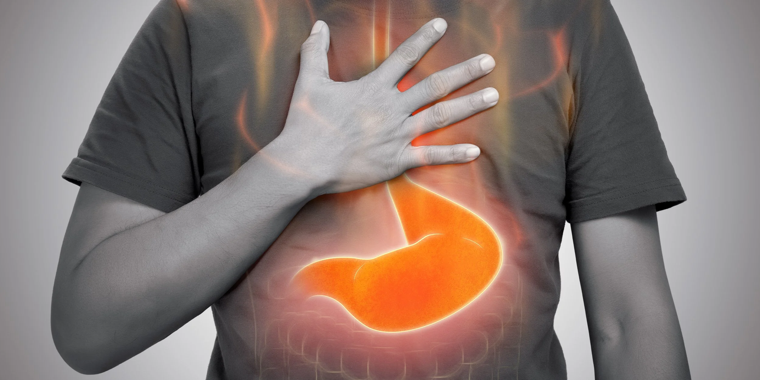 Acidità e reflusso: come prevenirli e ritrovare il benessere digestivo