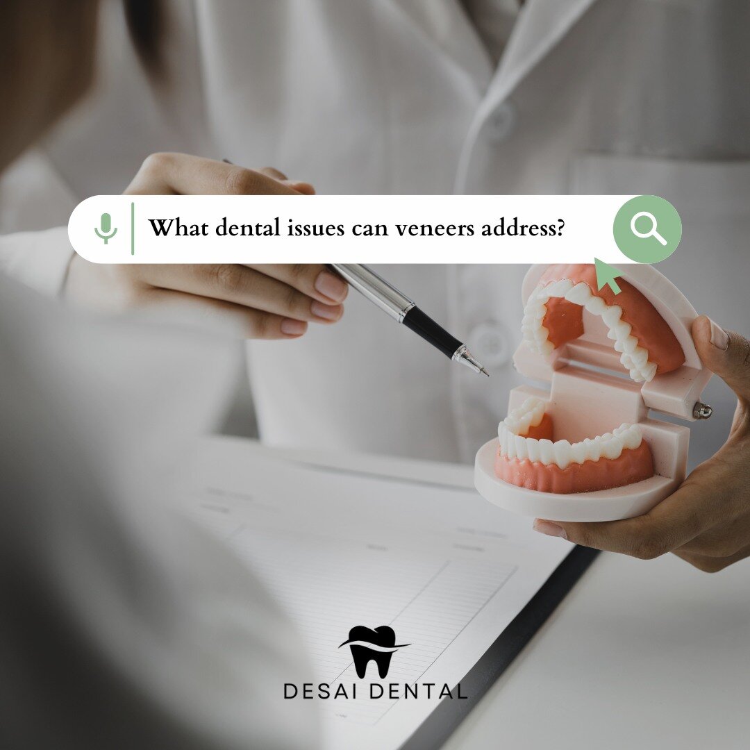 Curious about veneers? They can address issues like discoloration, gaps, and misalignment, giving you a flawless smile! 😁✨ Have more questions? Ask away! 

#DesaiDental #Veneers101 #SmileSolutions #DesaiDentalFAQ #AskUsAnything #WinterParkDentist