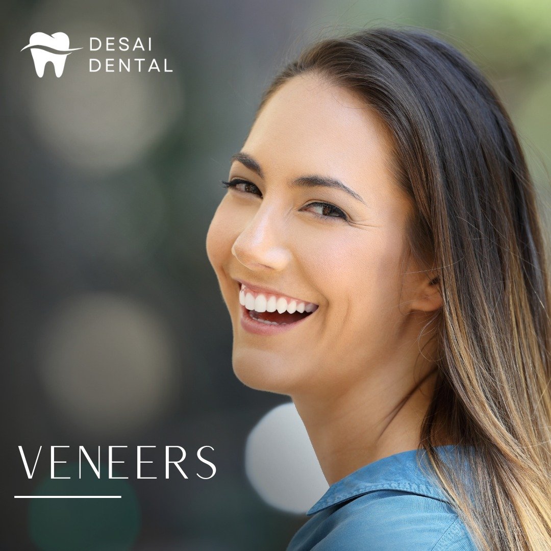 Transform your smile with veneers! Veneers are a popular cosmetic dental solution that can correct issues like discoloration, gaps, and misaligned teeth, giving you a beautiful, natural-looking smile. Schedule a consultation with us to learn more abo