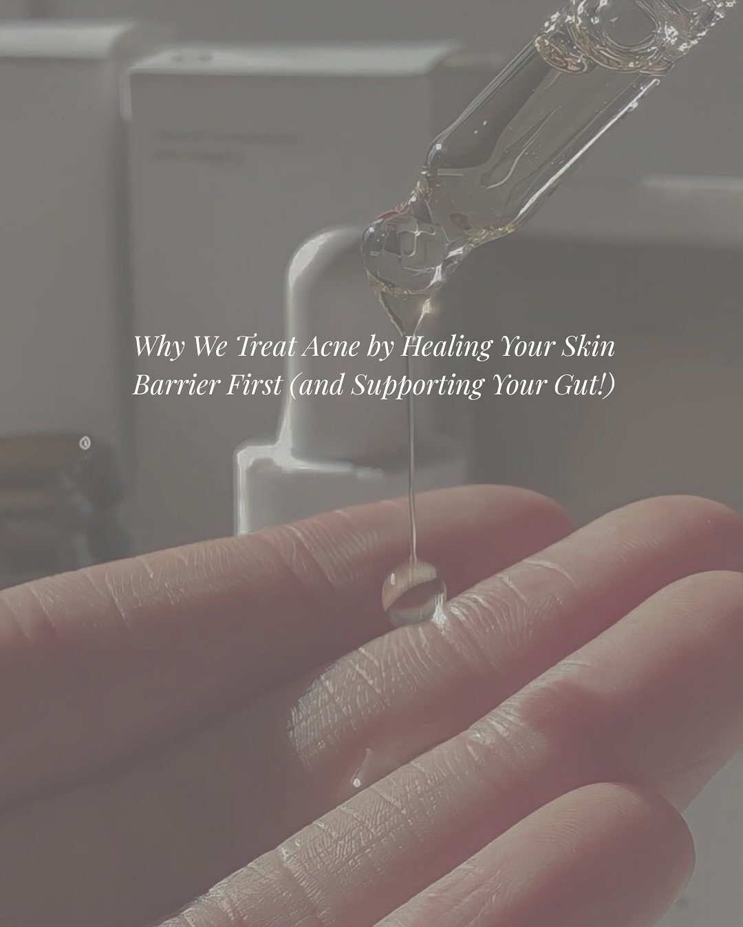 Most acne treatments focus on clearing the skin fast, but if your barrier and gut health are struggling, nothing really sticks.

At Method, we do things differently. We take a barrier-first, inside-out approach that calms inflammation, supports heali