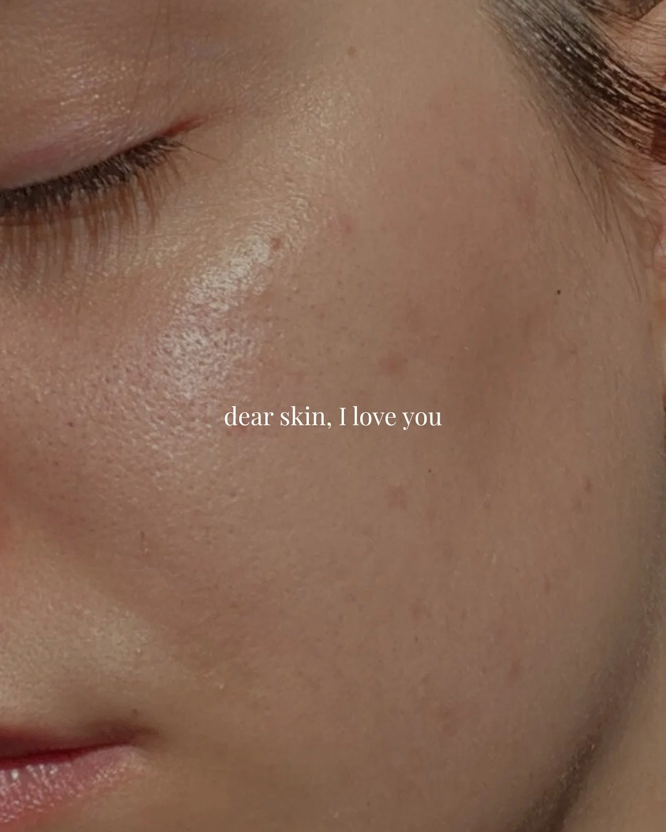 Feel Good Friday 

You can&rsquo;t hate your skin into healing. Stress can trigger breakouts so give yourself grace, take a deep breath and speak kindly to your reflection 🤎