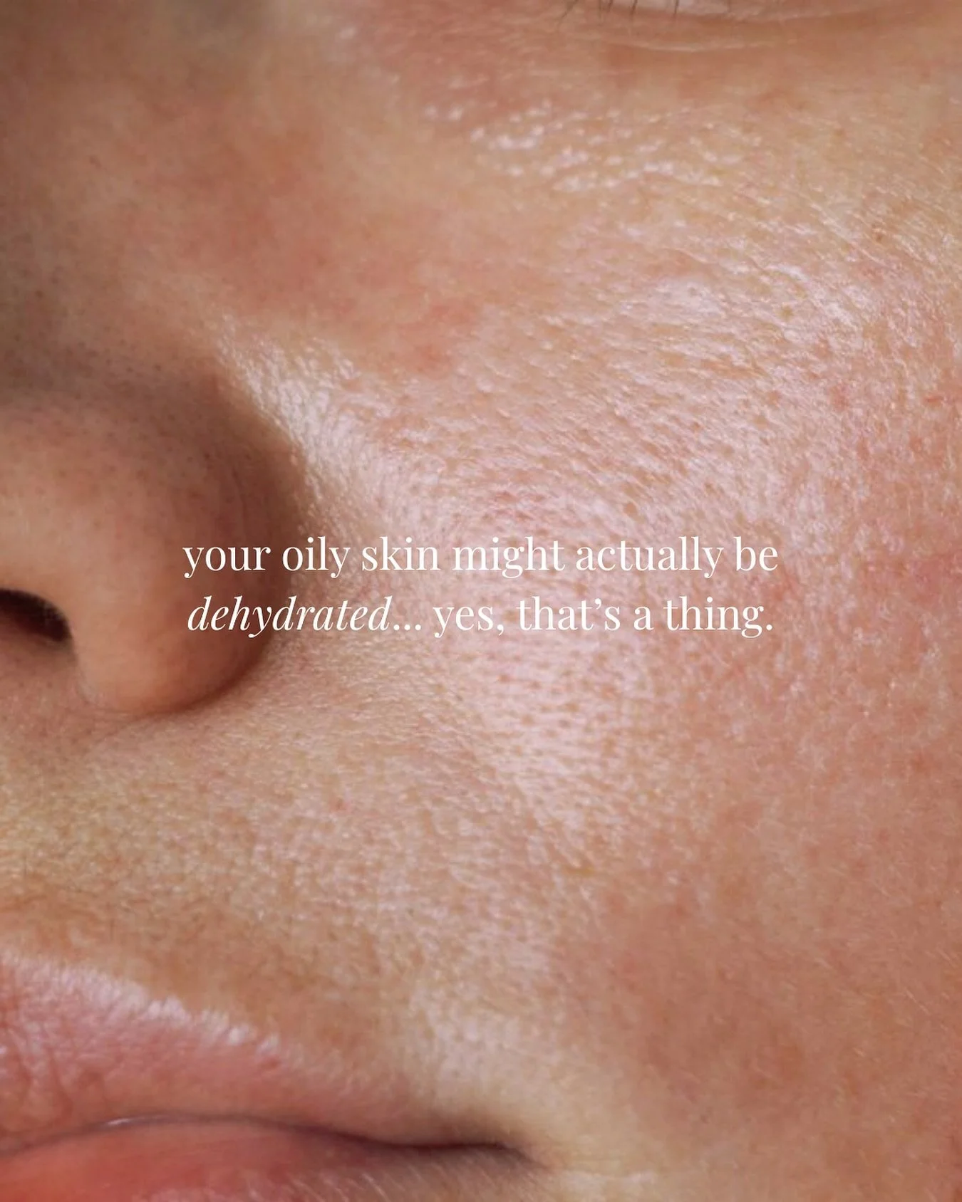 Think your skin is oily? It might actually be dehydrated.

When the skin doesn&rsquo;t have enough water, it tries to protect itself by producing more oil. This is called transepidermal water loss (TEWL), and it&rsquo;s one of the most common causes 