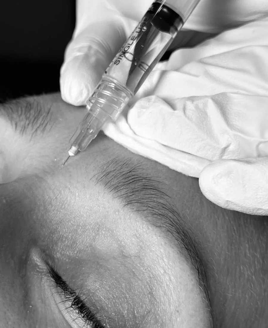 @dr.alexachichaknd is back in clinic on Thursday, April 16 from 3&ndash;6 pm, and we have a few neuromodulator appointments available.

If you&rsquo;ve been thinking about booking or you&rsquo;ve been curious and want to have a proper conversation fi