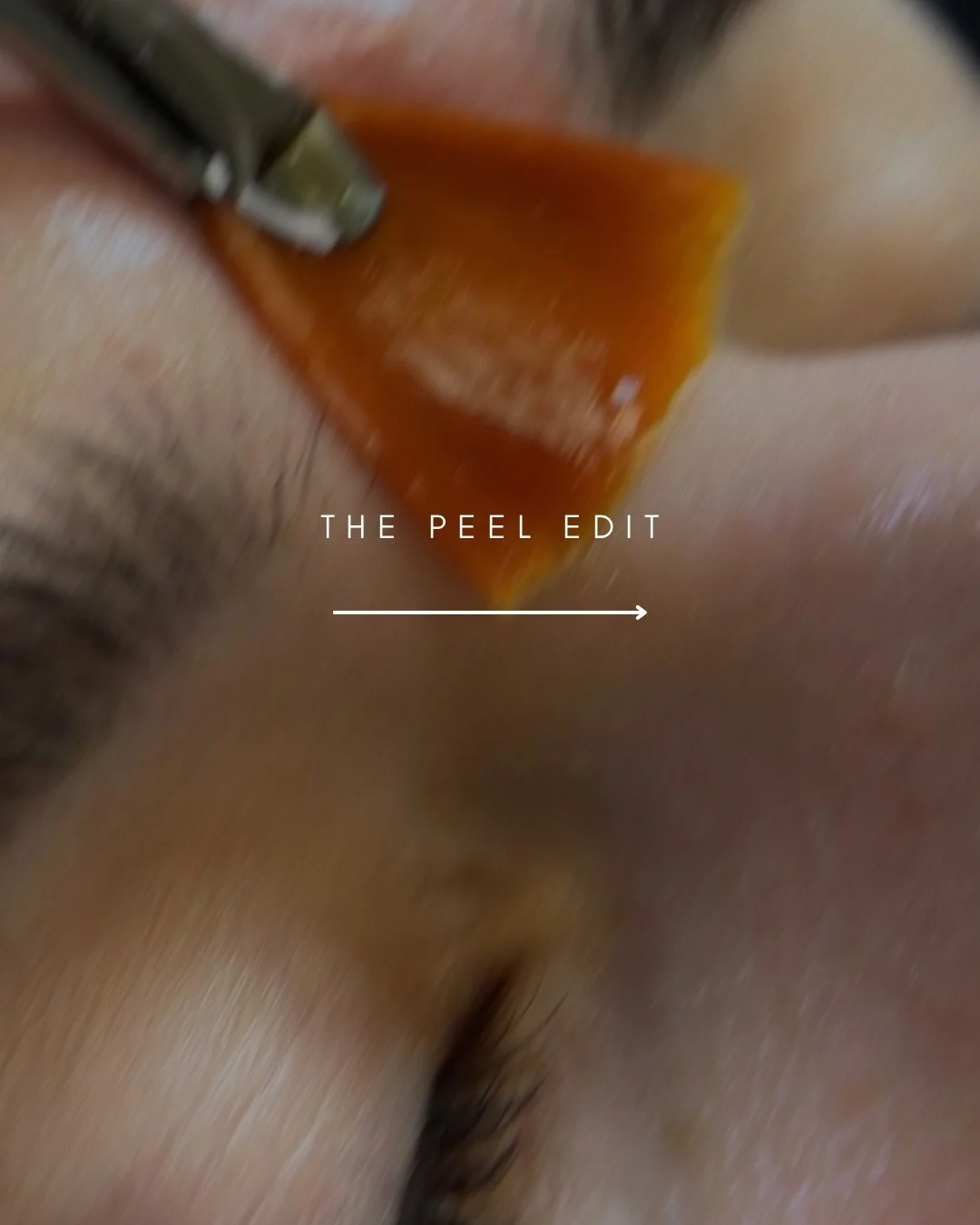 The Peel Edit ✨

We&rsquo;re hosting May 31st | 11&ndash;3PM

An intentional, skin-focused event centred around real results and a fresh reset. Custom chemical peels, guided post-care, curated gift bags, and exclusive event-only skincare offers.

Lim