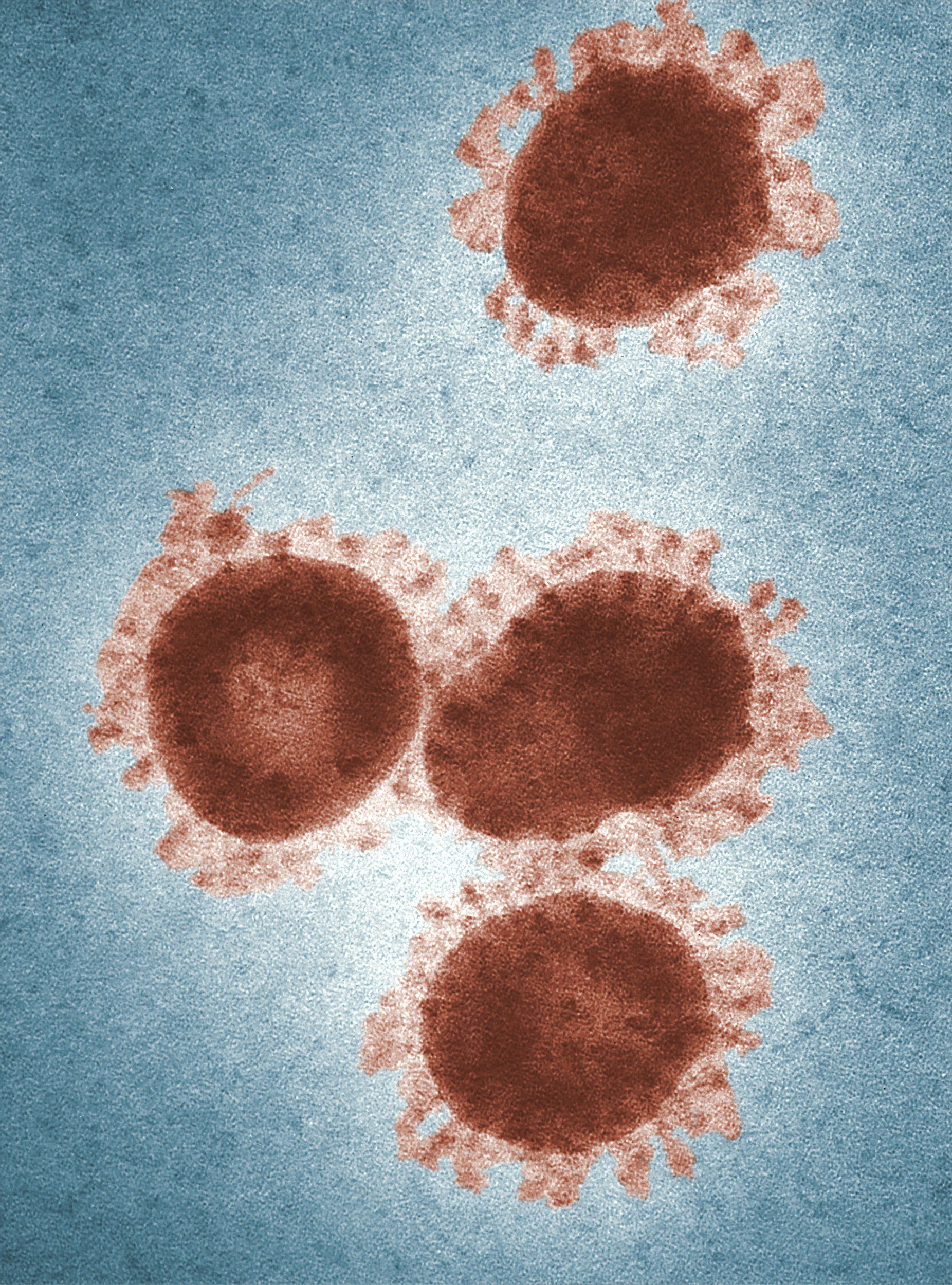 Gut viruses affect brain function