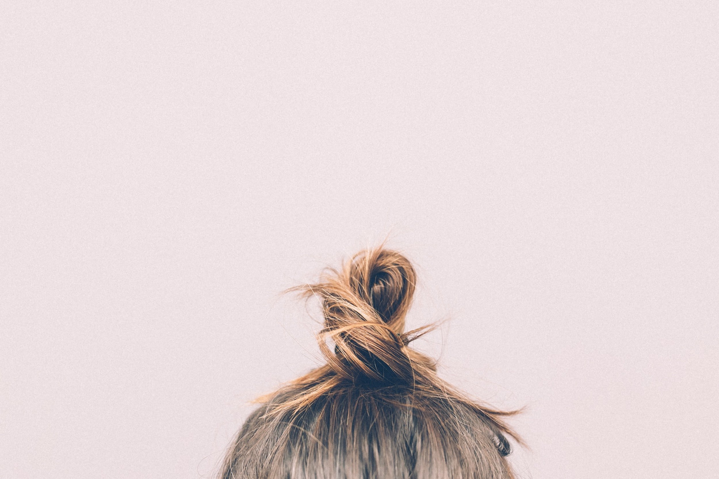 verschillende vormen van alopecia 