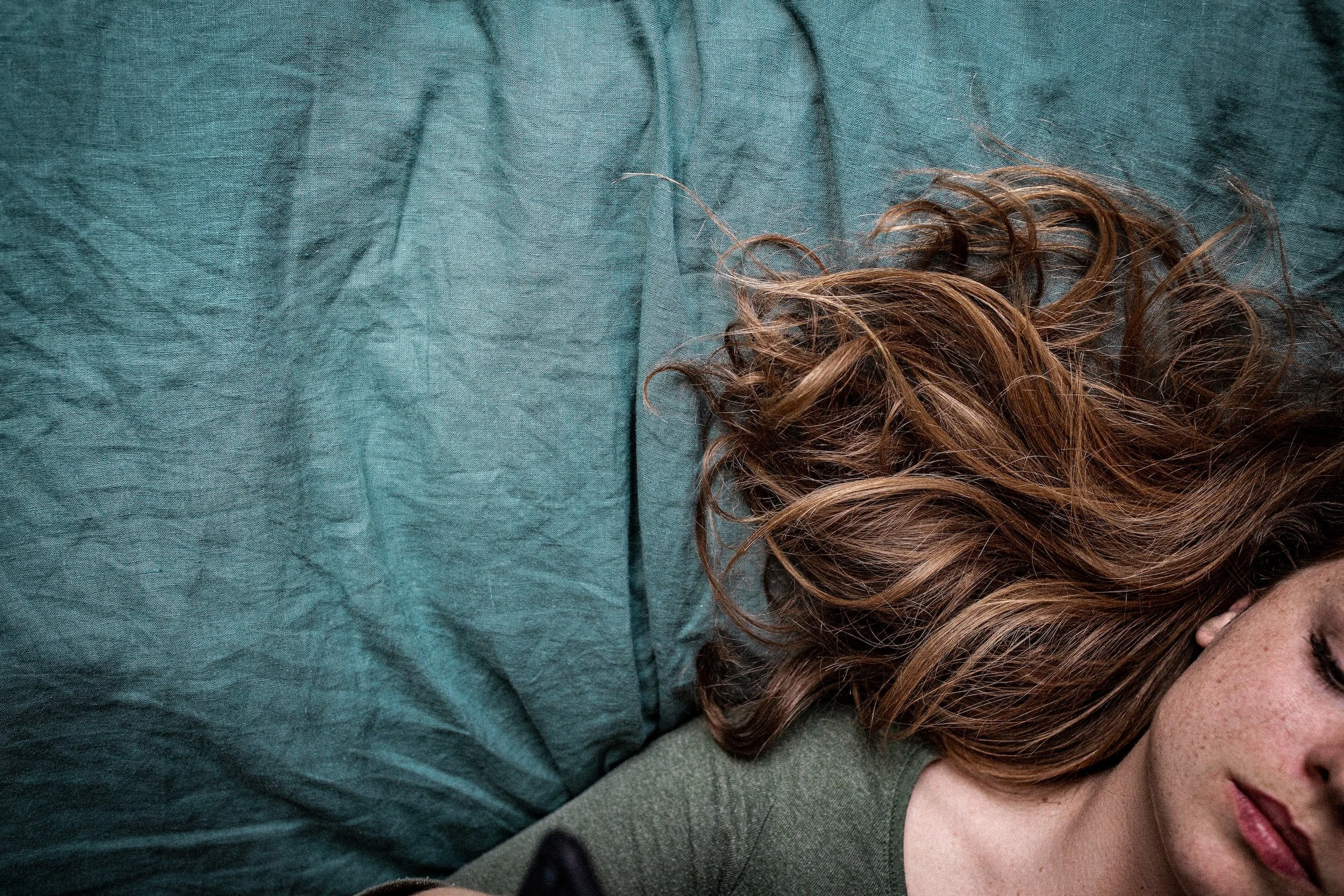 alopecia oorzaken