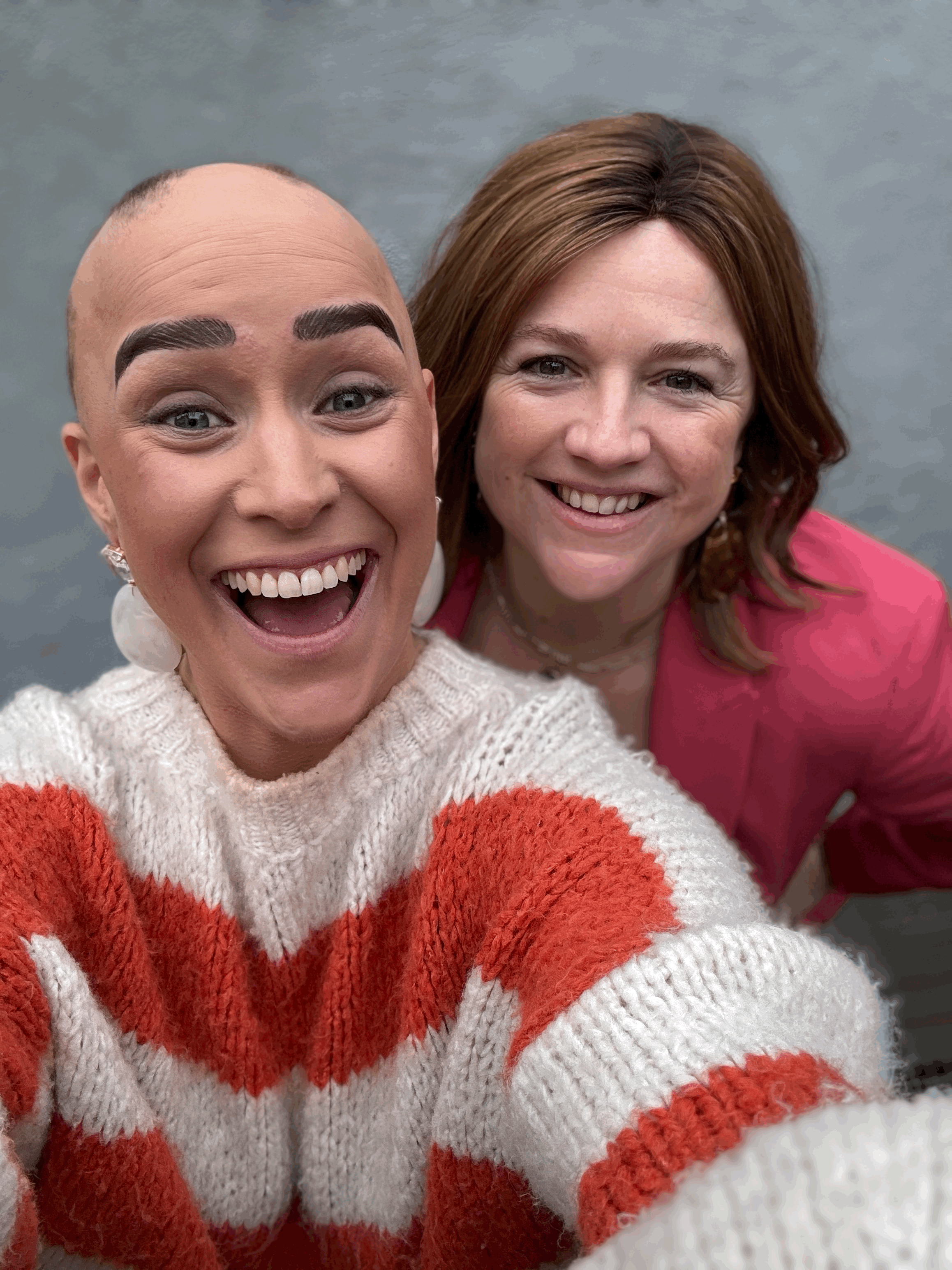 In gesprek met Veronique Pardoen: twee vrouwen, één missie in de alopecia wereld