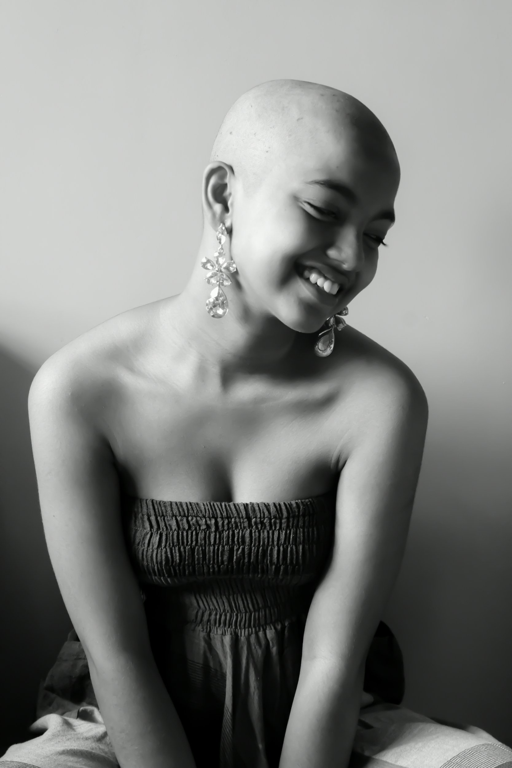 Uitleg over alopecia als haarziekte, verschillende vormen van haaruitval en de mentale impact bij vrouwen