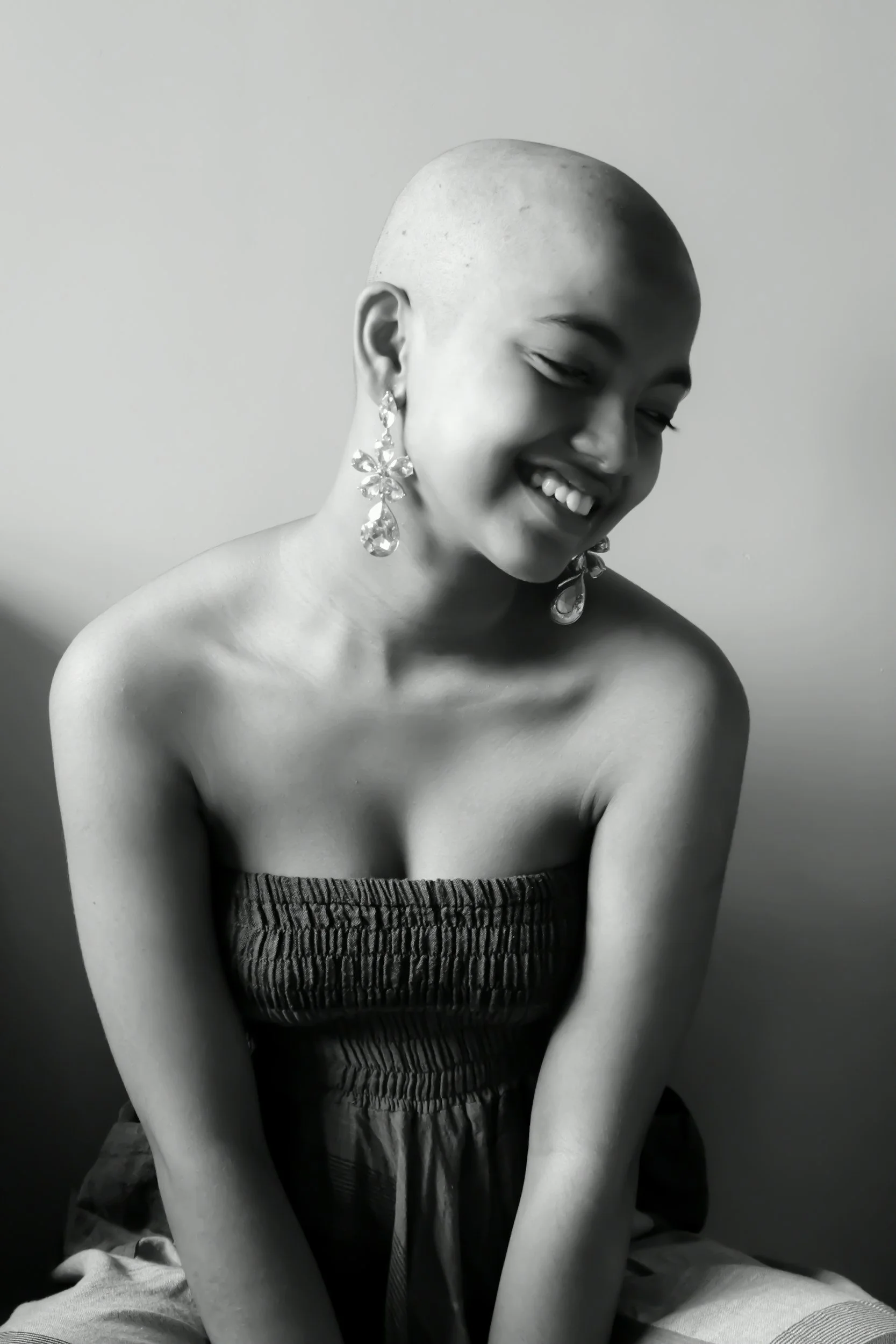 Alopecia: wat je moet weten over deze haarziekte (oorzaken &amp; impact)