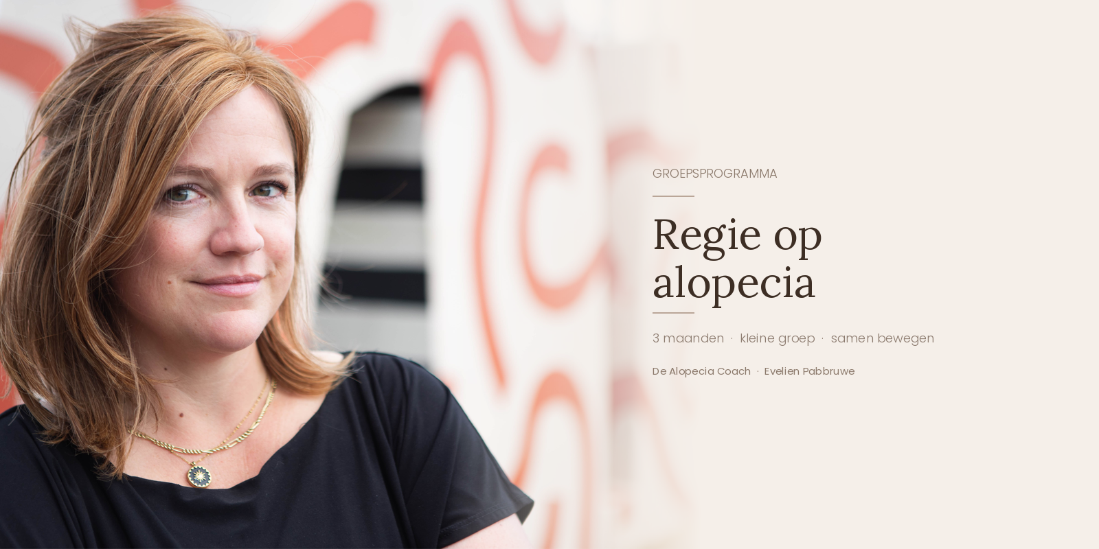 Omgaan met alopecia als vrouw