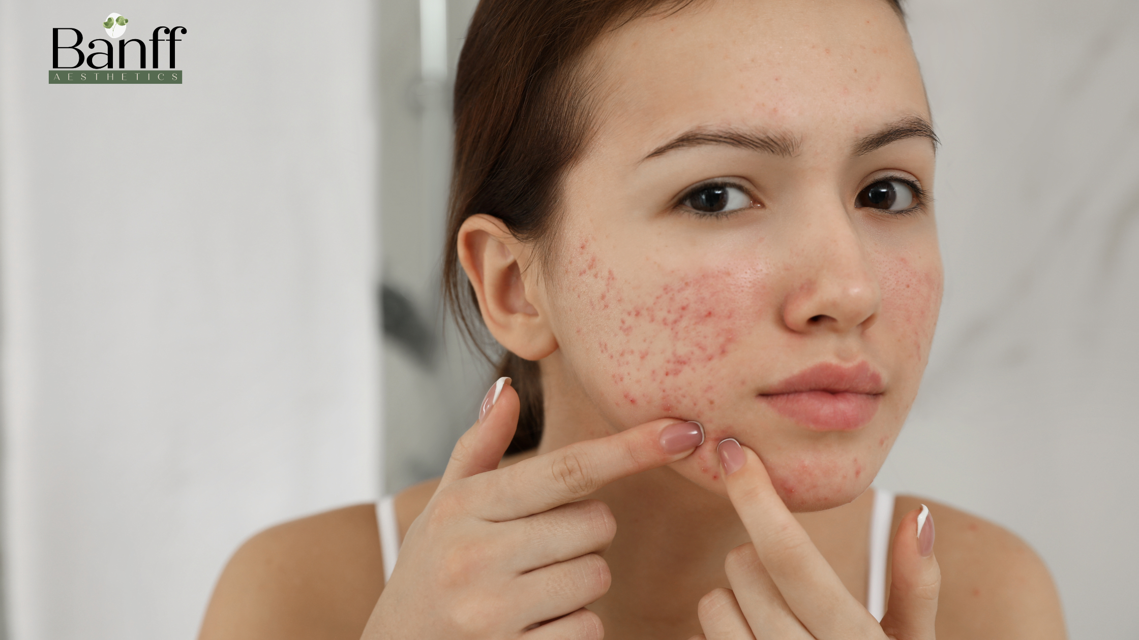 How Picosecond Laser Treatments Help Improve Skin Texture