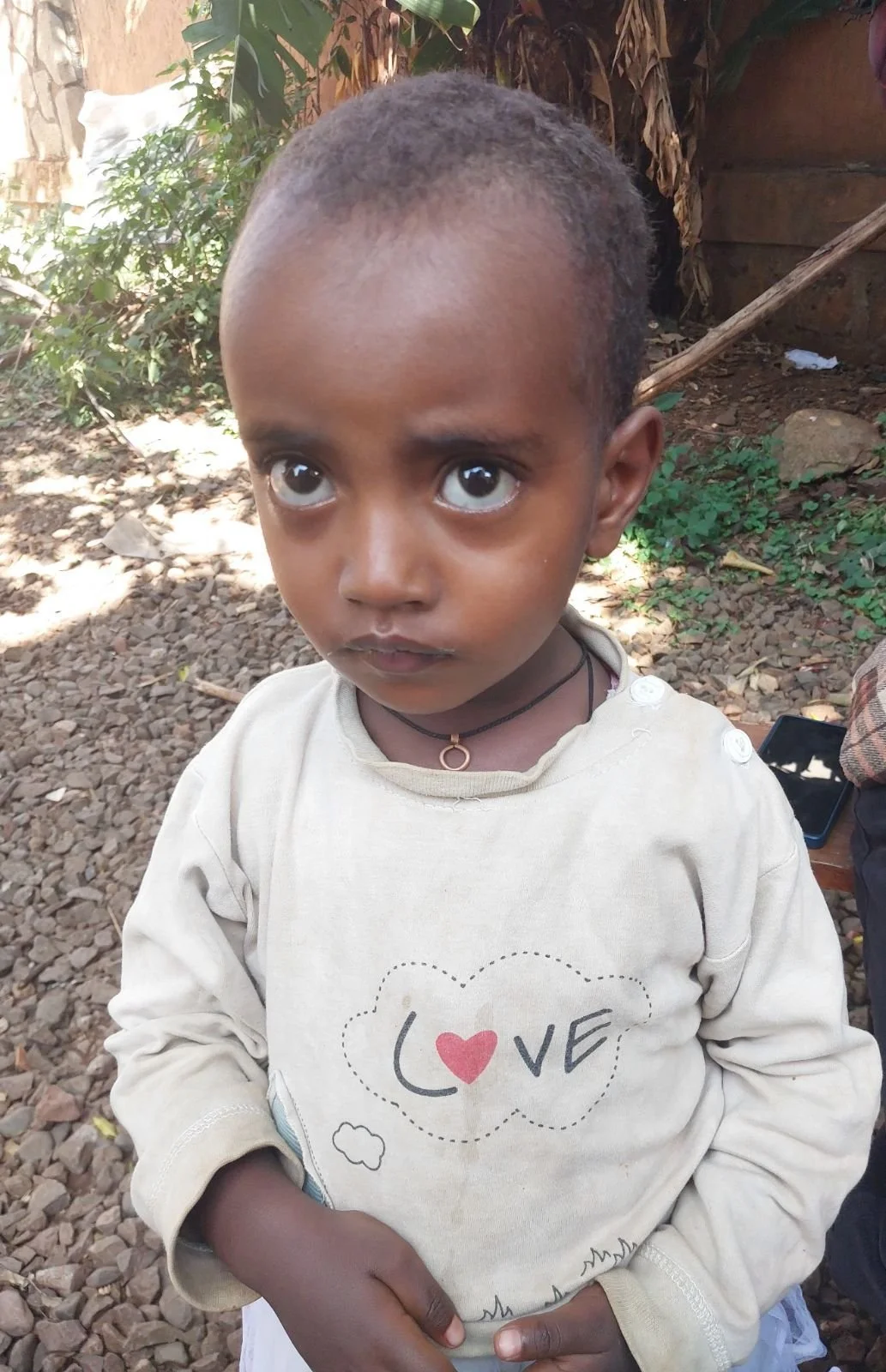 Bemnet | Age 2 | Birthday 05/16/23 | Her father is disabled, her mother works day labor. 