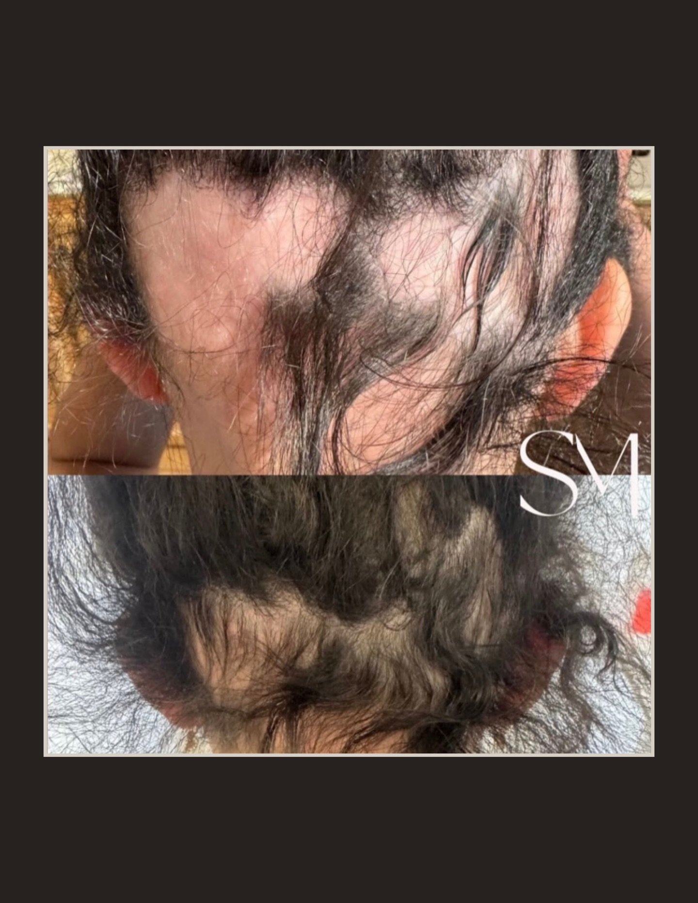 Before &amp; afters that say everything 👏🏼
Thoughtful, customized care by Molly Gee ✨ Each transformation reflects a fully personalized treatment plan that focused on balance, restoration, and results that ultimately lead to confidence.

Refined. I