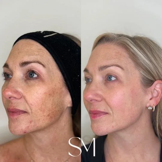 Enlighten Peel