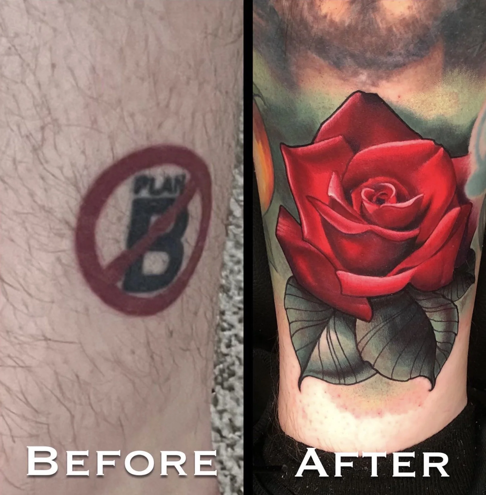 Comparison photo showing a person's skin before and after tattoo removal. The left side shows skin with a small tattoo of a face with headphones inside a circle, while the right side shows the same area with no tattoo, replaced by a vibrant red rose tattoo with green leaves.