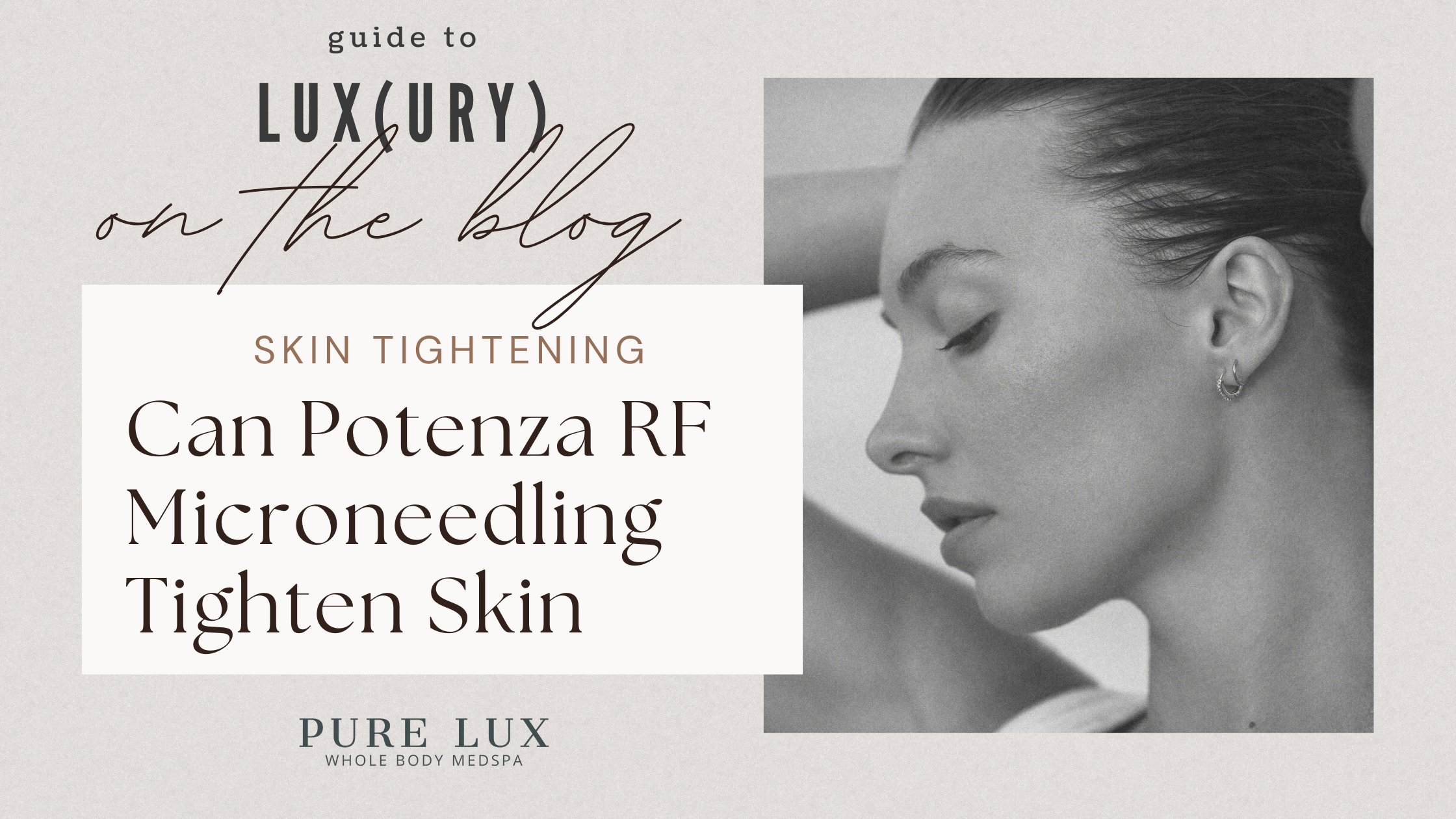Why Skin Starts to Sag — and How Potenza RF Microneedling Helps