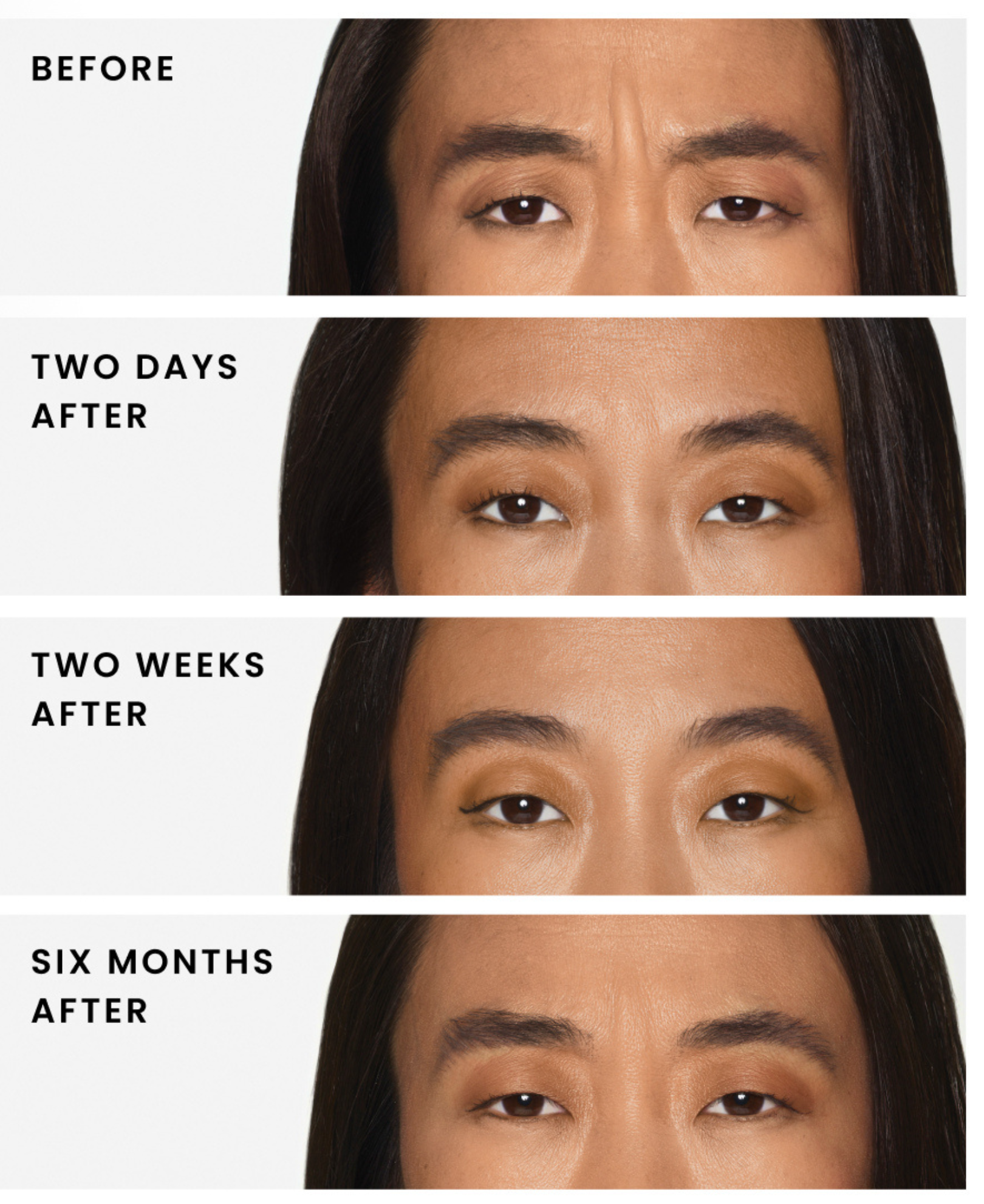 Daxxify in Edina Results.png