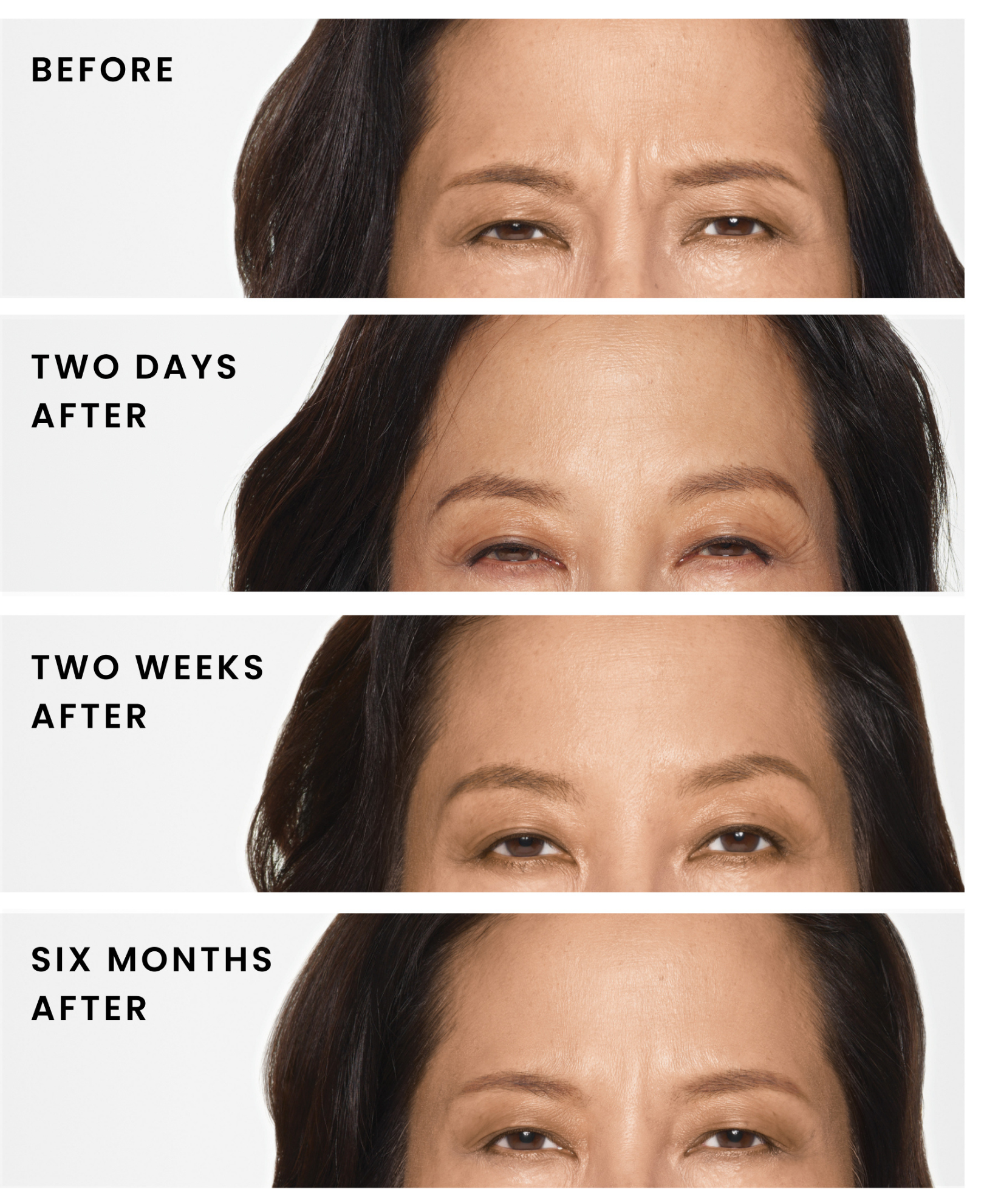 Daxxify in Eden Prairie Results.png