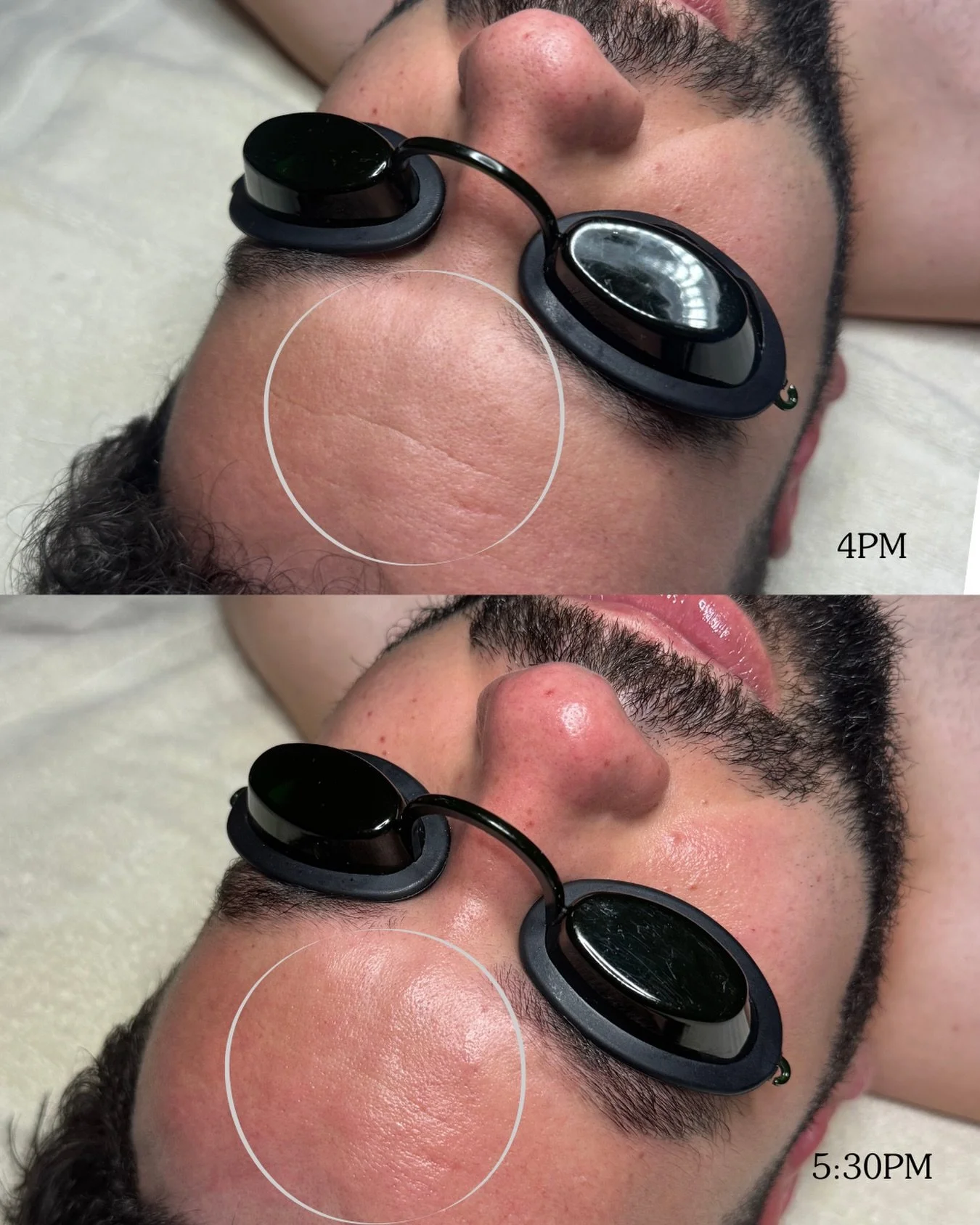 So much can be achieved with facial massage and correct choice of products. In a matter of 1.5 hrs you can see your wrinkles soften and your face feels relaxed and untangled ☺️