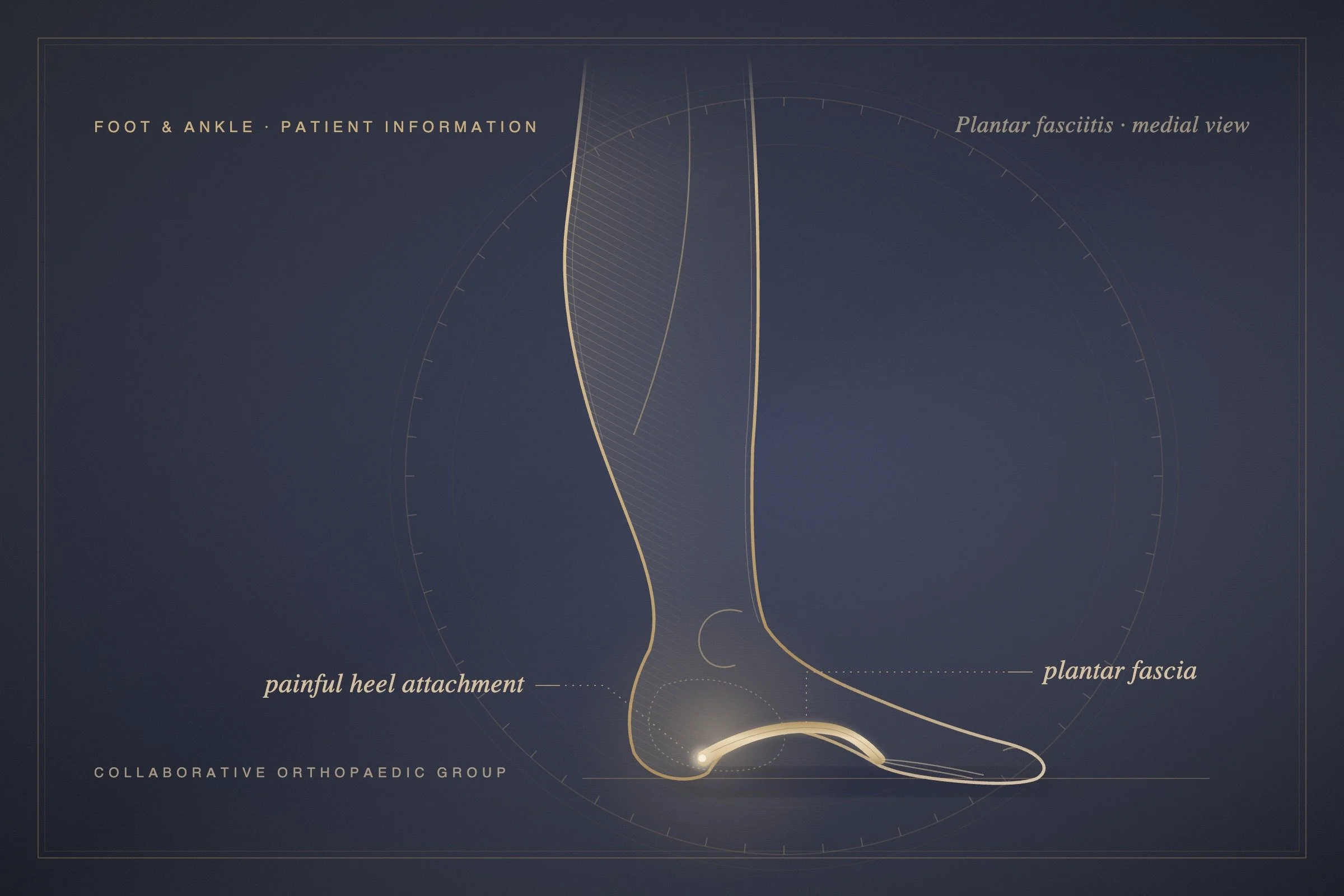 Why does my heel hurt most when I get out of bed?