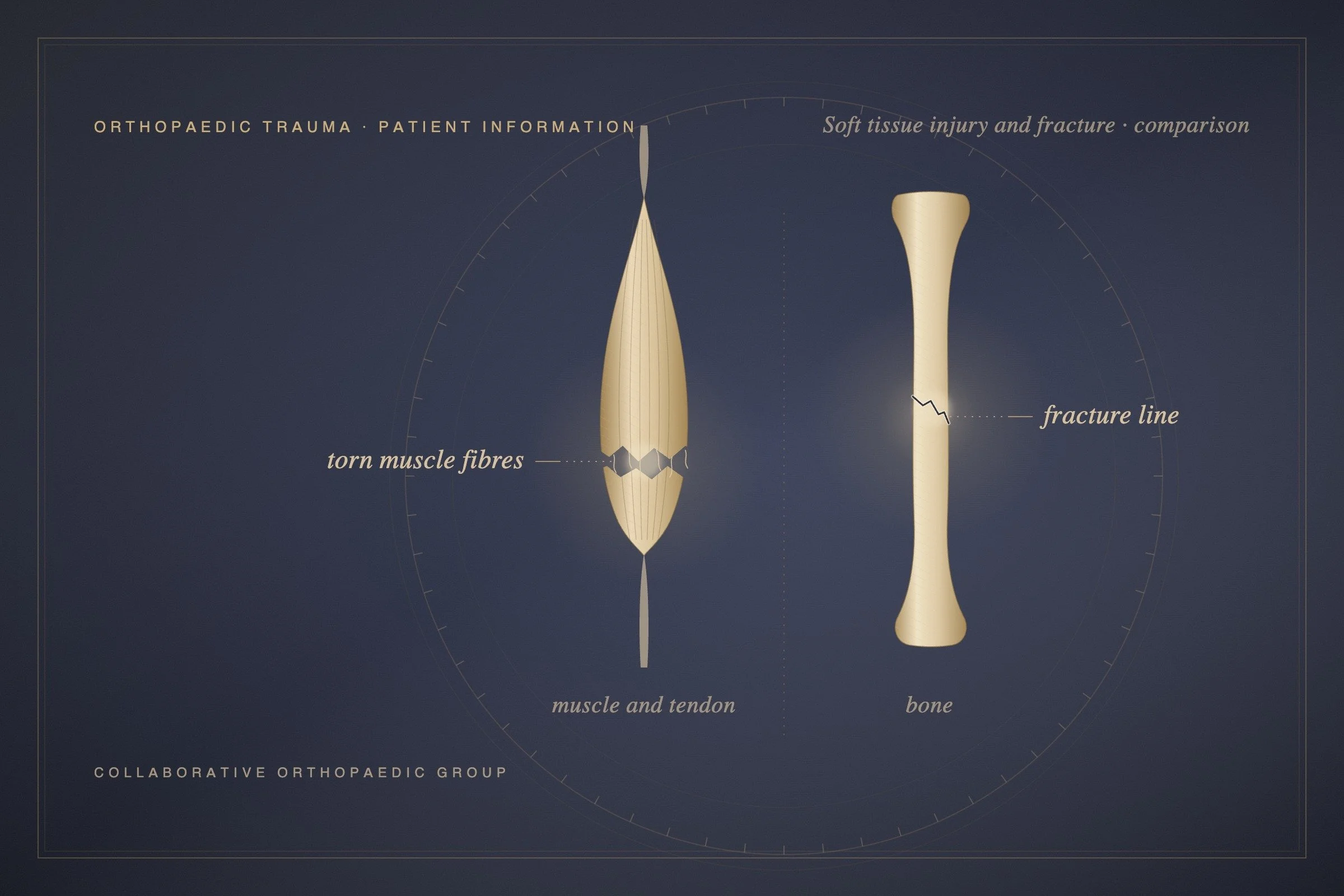 How Are Soft Tissue Injuries Treated Differently From Fractures?
