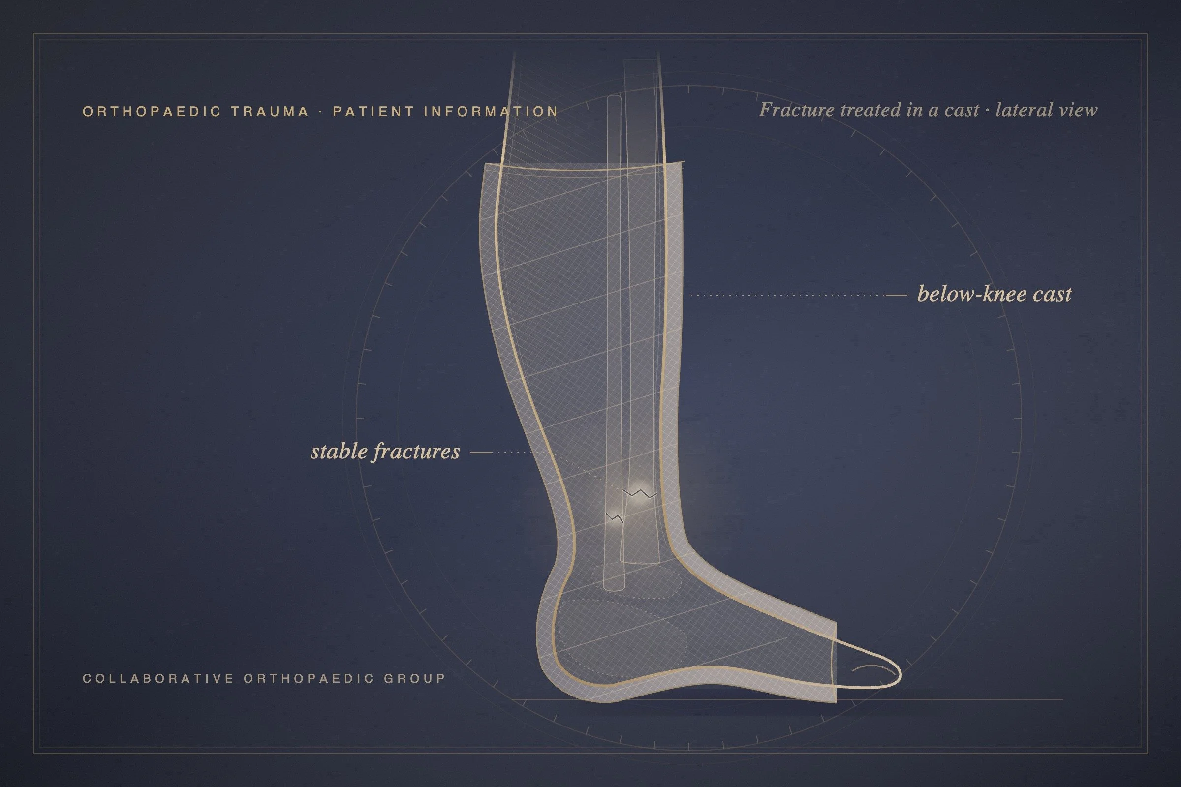 Do All Fractures Need Surgery?