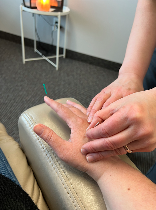 What is Acupuncture and How Does it Work?