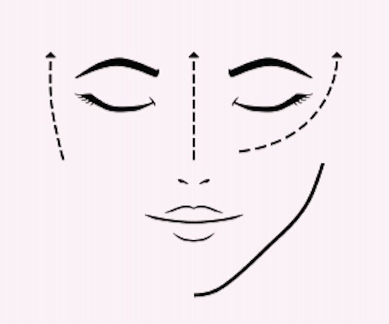 skin-booster-injections-dr-kimberly-lim