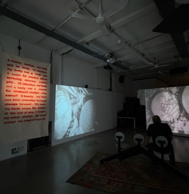 What Is A Body Worth?