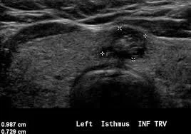 Thyroid Conditions — Dr Simone Geere