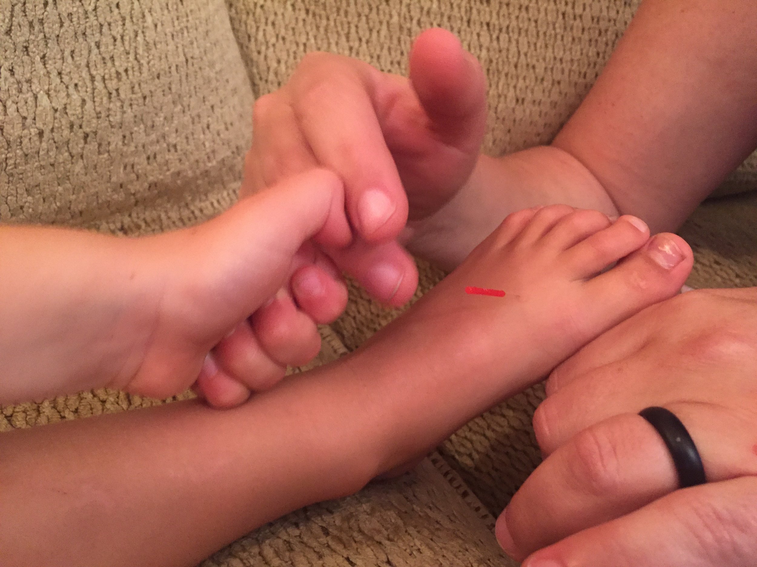Acupuncture for kids