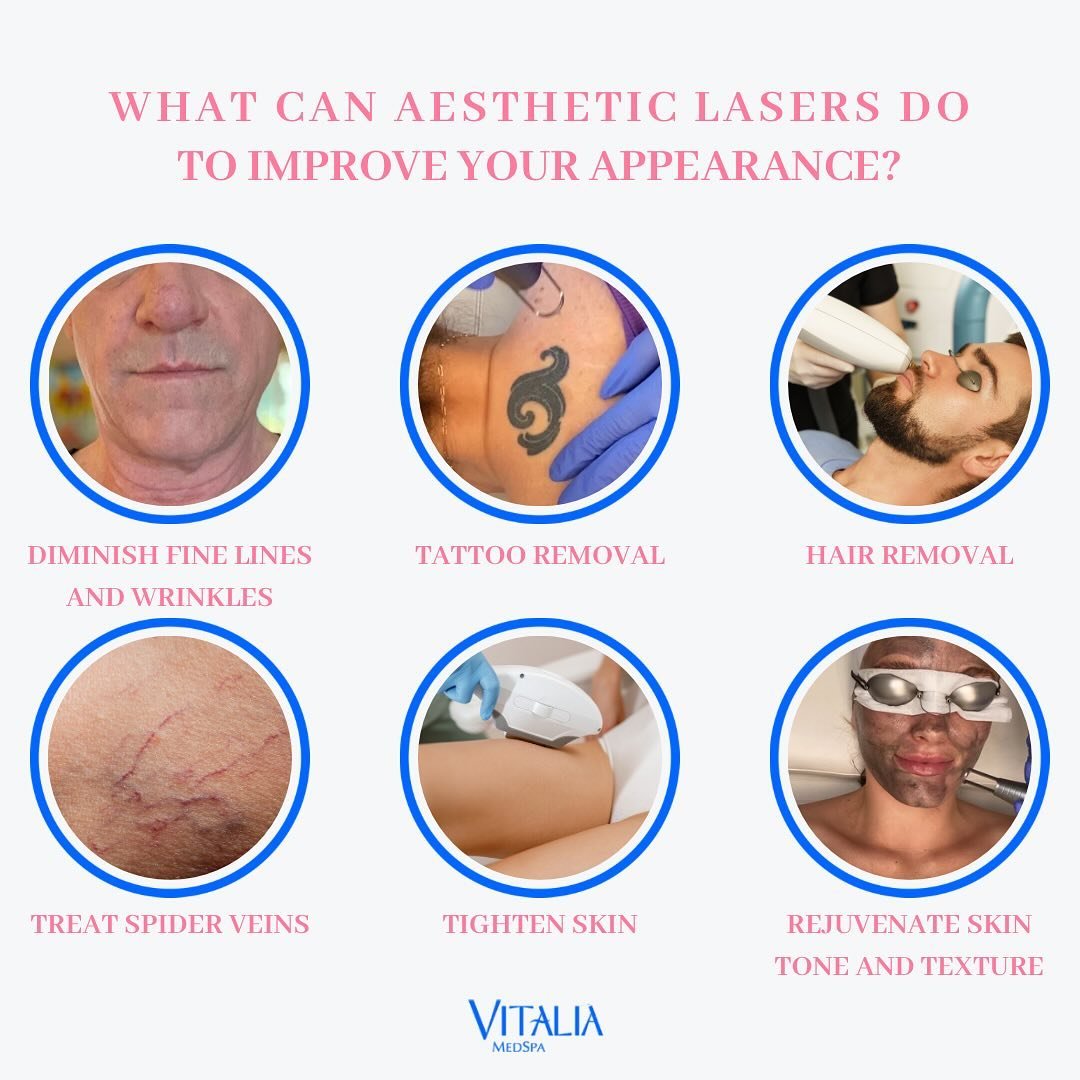 Lasers use light energy to treat countless aesthetic needs. From facial resurfacing to eliminating body hair, aesthetic lasers are an amazing non-surgical solution to your beauty needs. 

Considering a laser treatment? Schedule a consultation with Vi