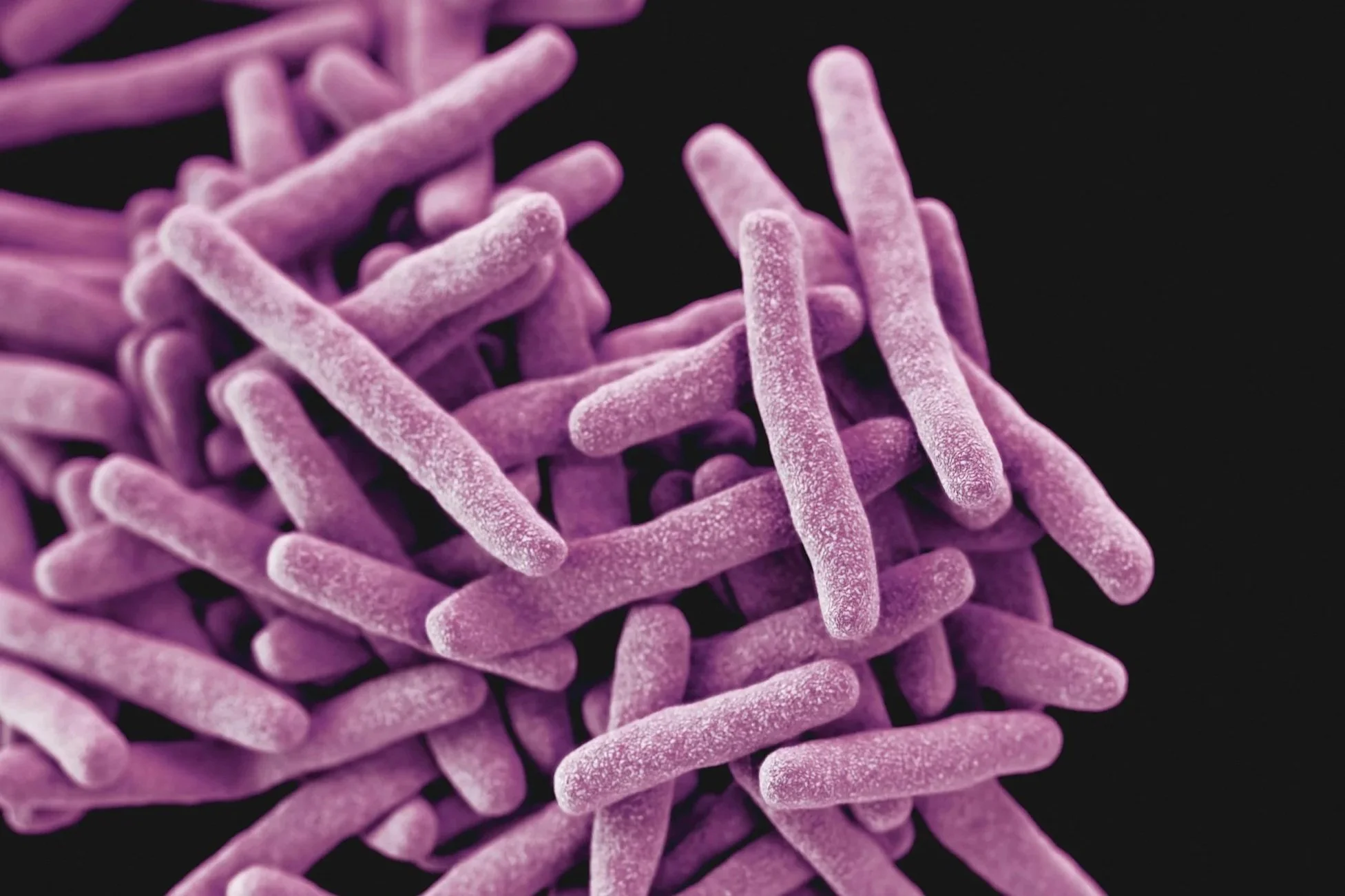 Guggenheim Museum Among Buildings Impacted By Legionnaires' Disease Growing Outbreak On The Upper East Side