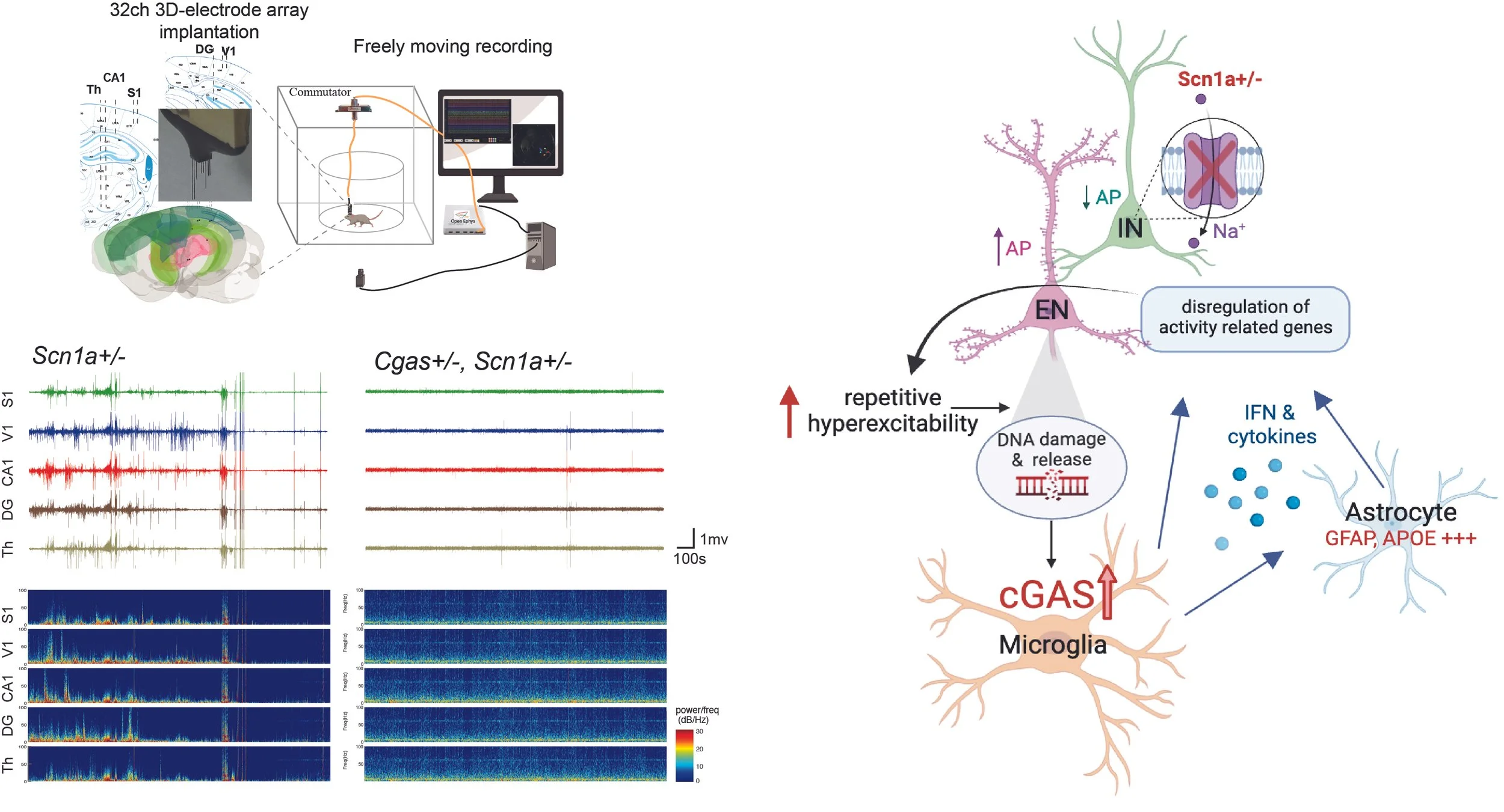 cGAS-mediated type I IFN signaling contributes to disease progression in drug-refractory epilepsy