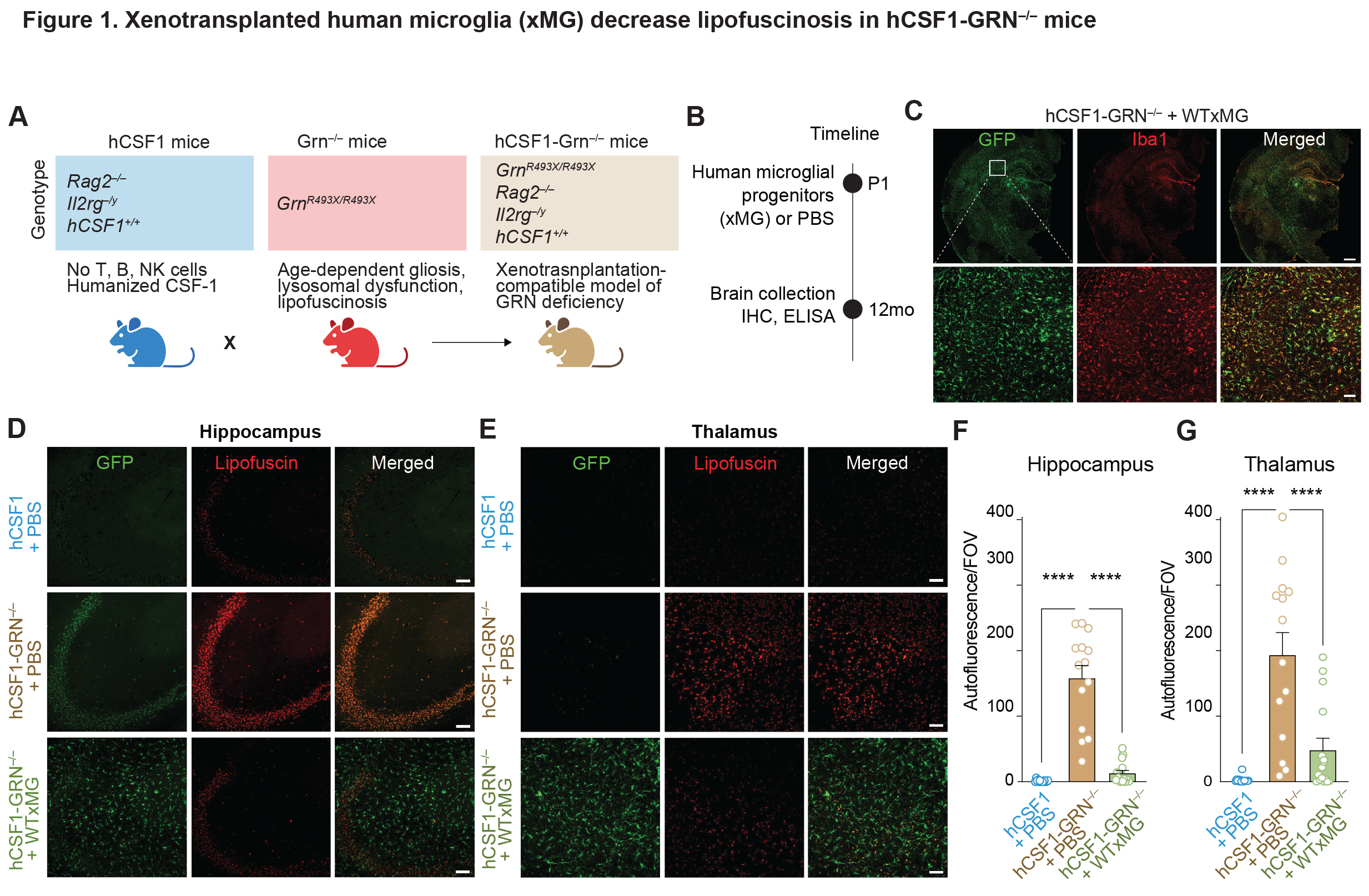 Transplantation of human iPSC-derived microglia ameliorates neuropathology and circuit dysfunction in progranulin-deficient mice