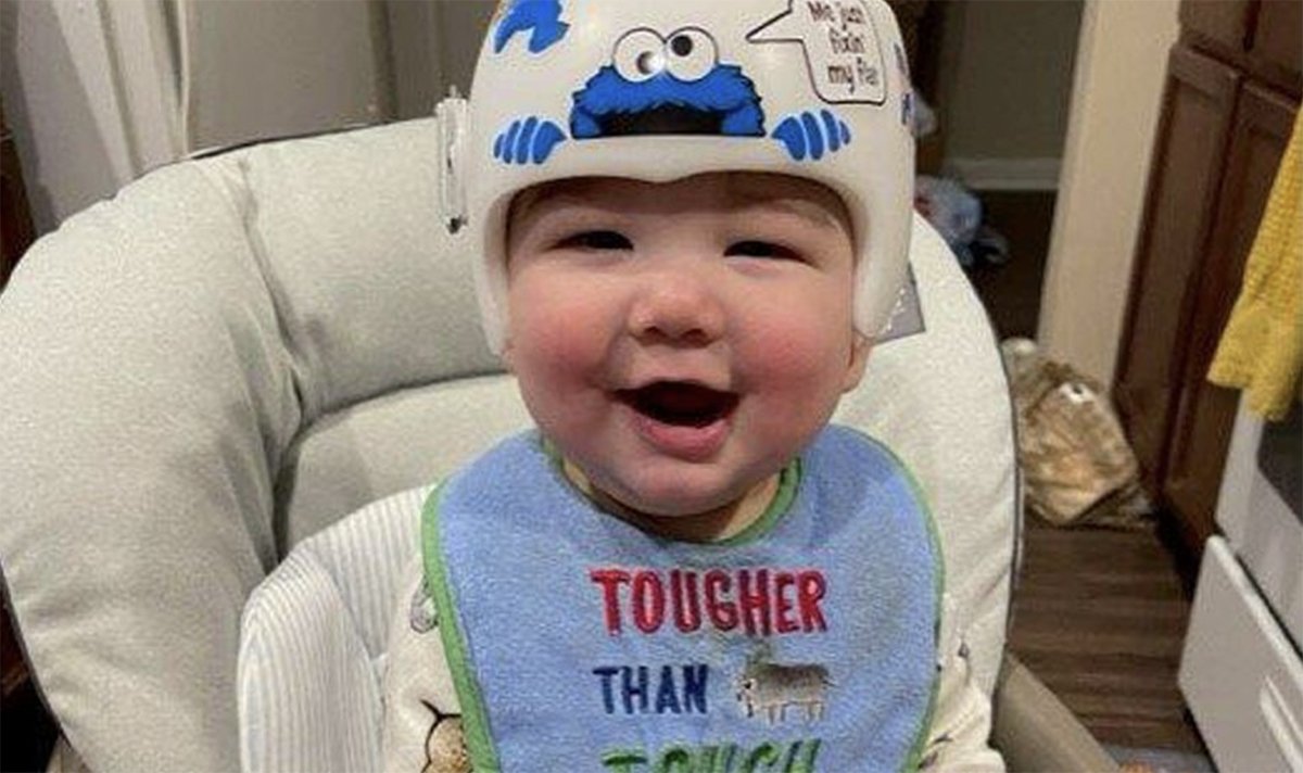 Cranial Technologies Baby Helmet Therapy Cost Cheap Helmet