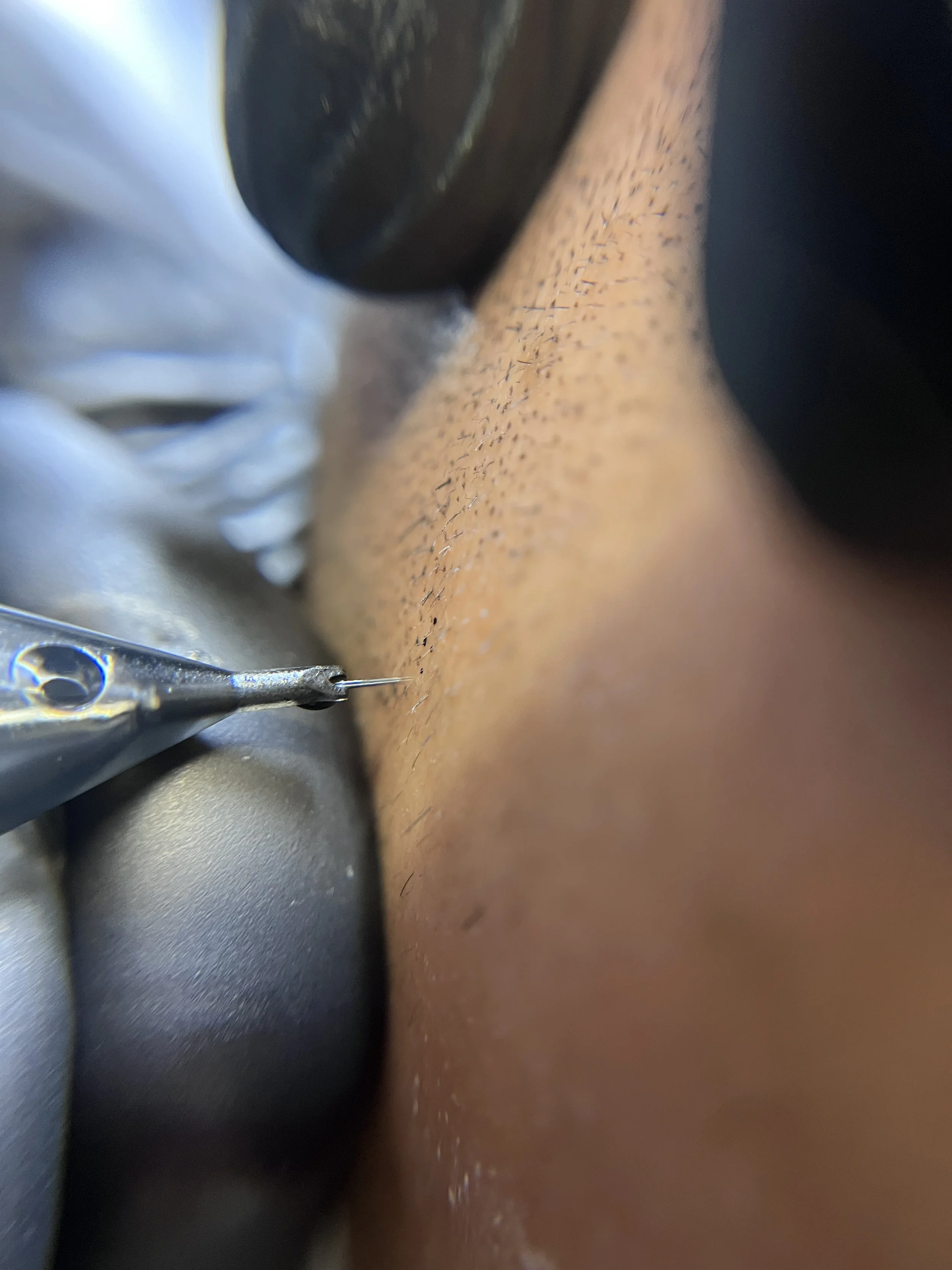 Close-up of a tattoo needle applying ink to skin during a tattoo procedure.